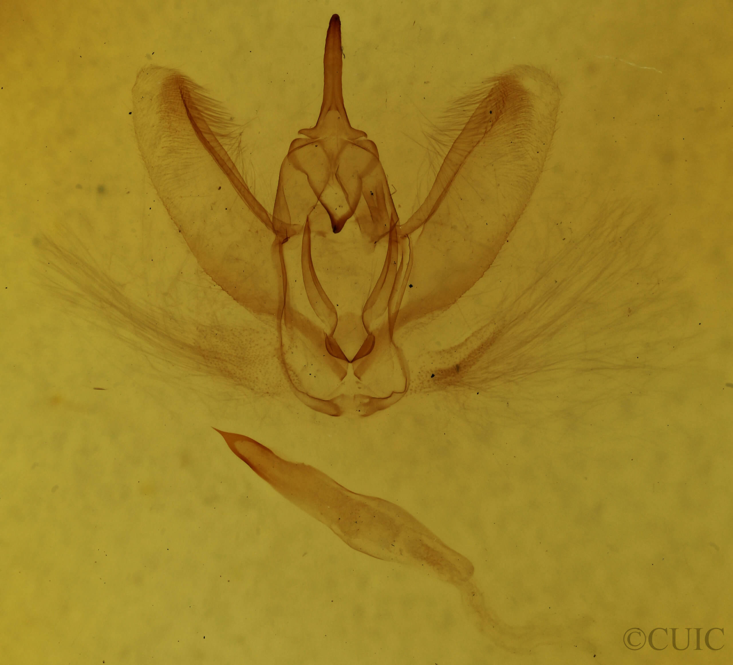 genitalia view of adult Metarranthis amyrisaria