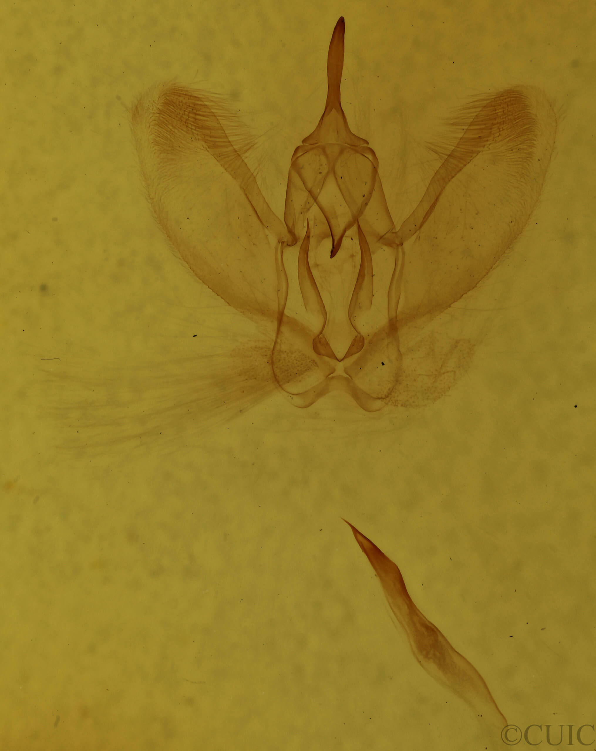 genitalia view of adult Metarranthis amyrisaria