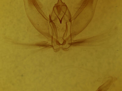 genitalia view of adult Metarranthis angularia
