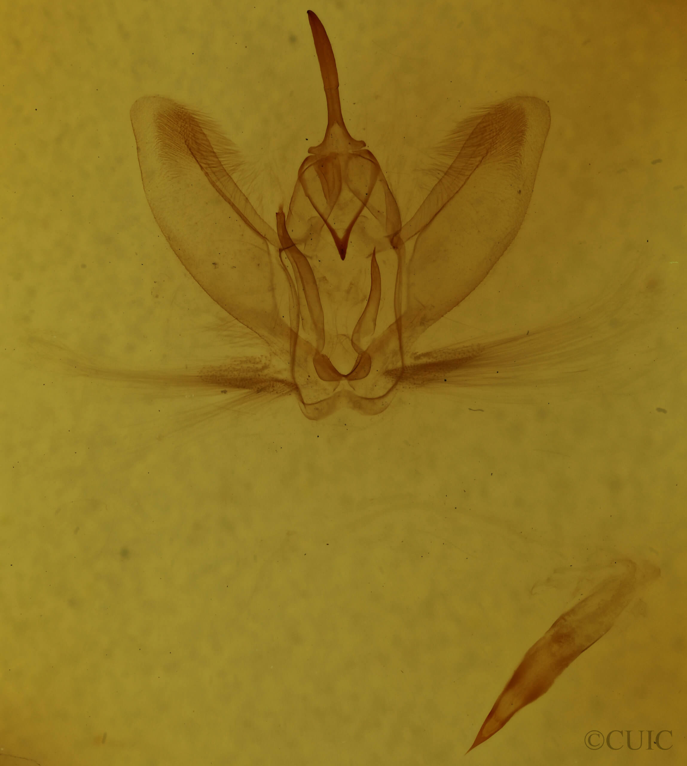 genitalia view of adult Metarranthis angularia