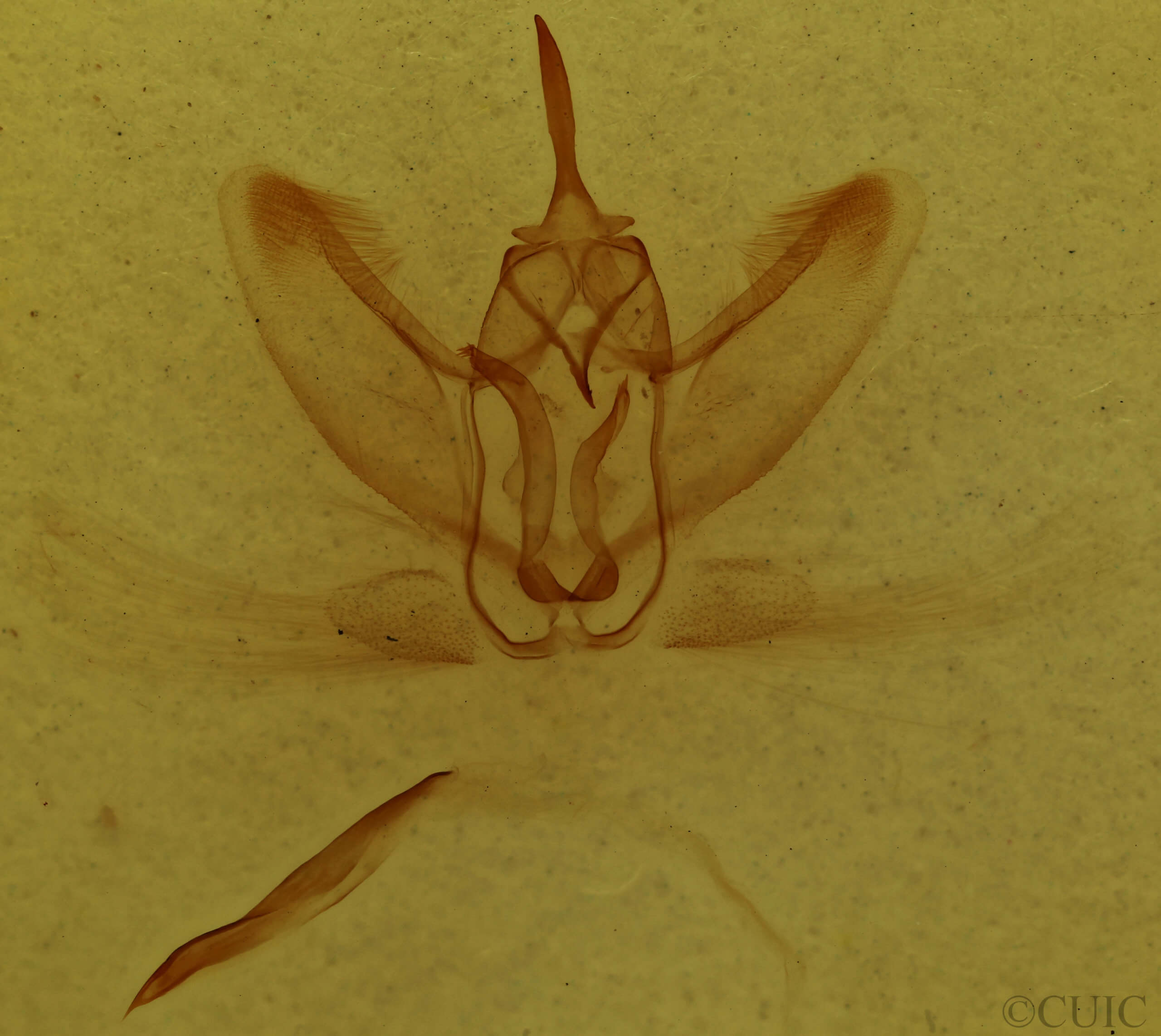 genitalia view of adult Metarranthis duaria