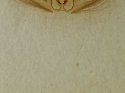 genitalia view of adult Metarranthis homuraria