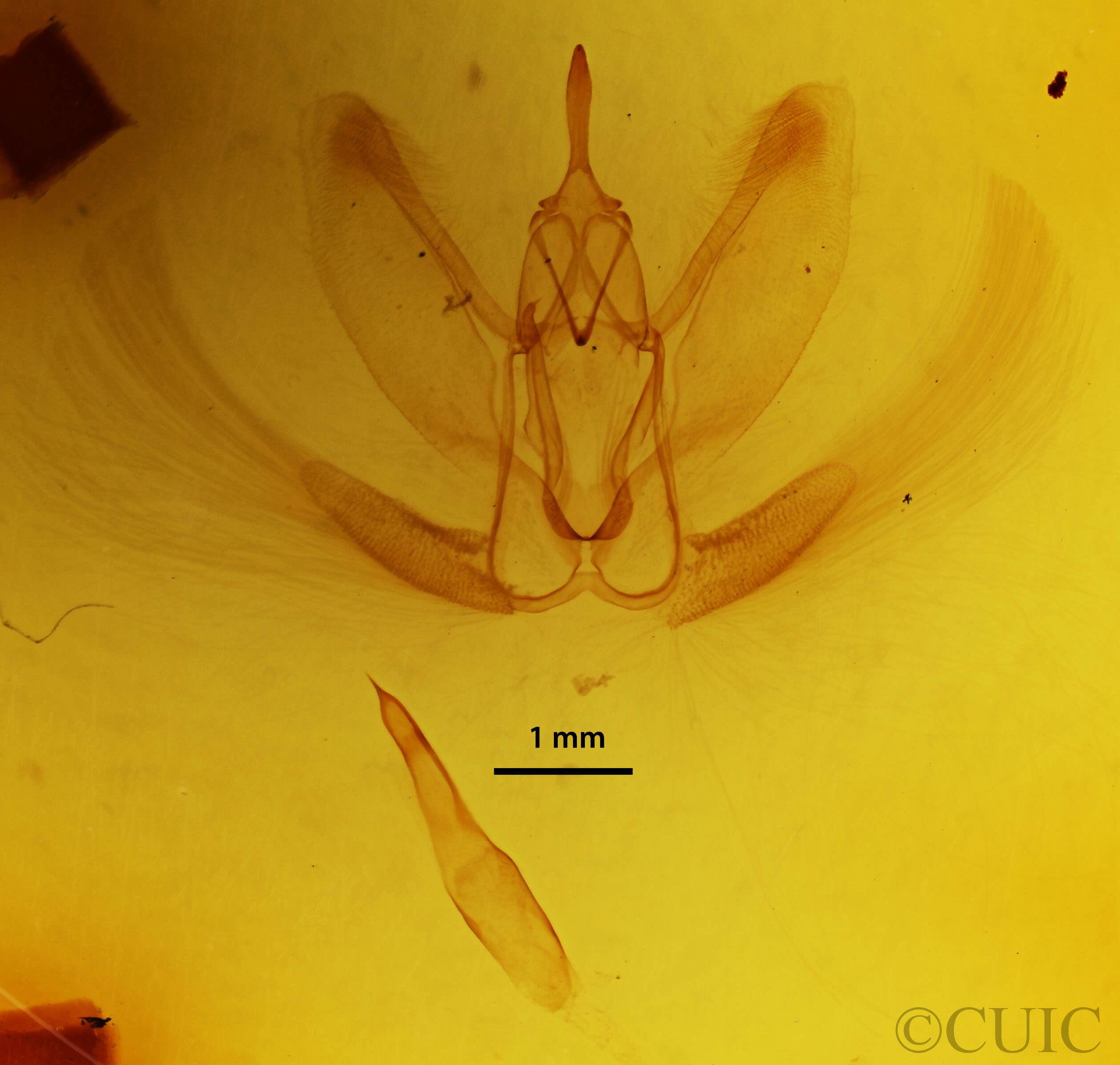 genitalia view of adult Metarranthis hypochraria