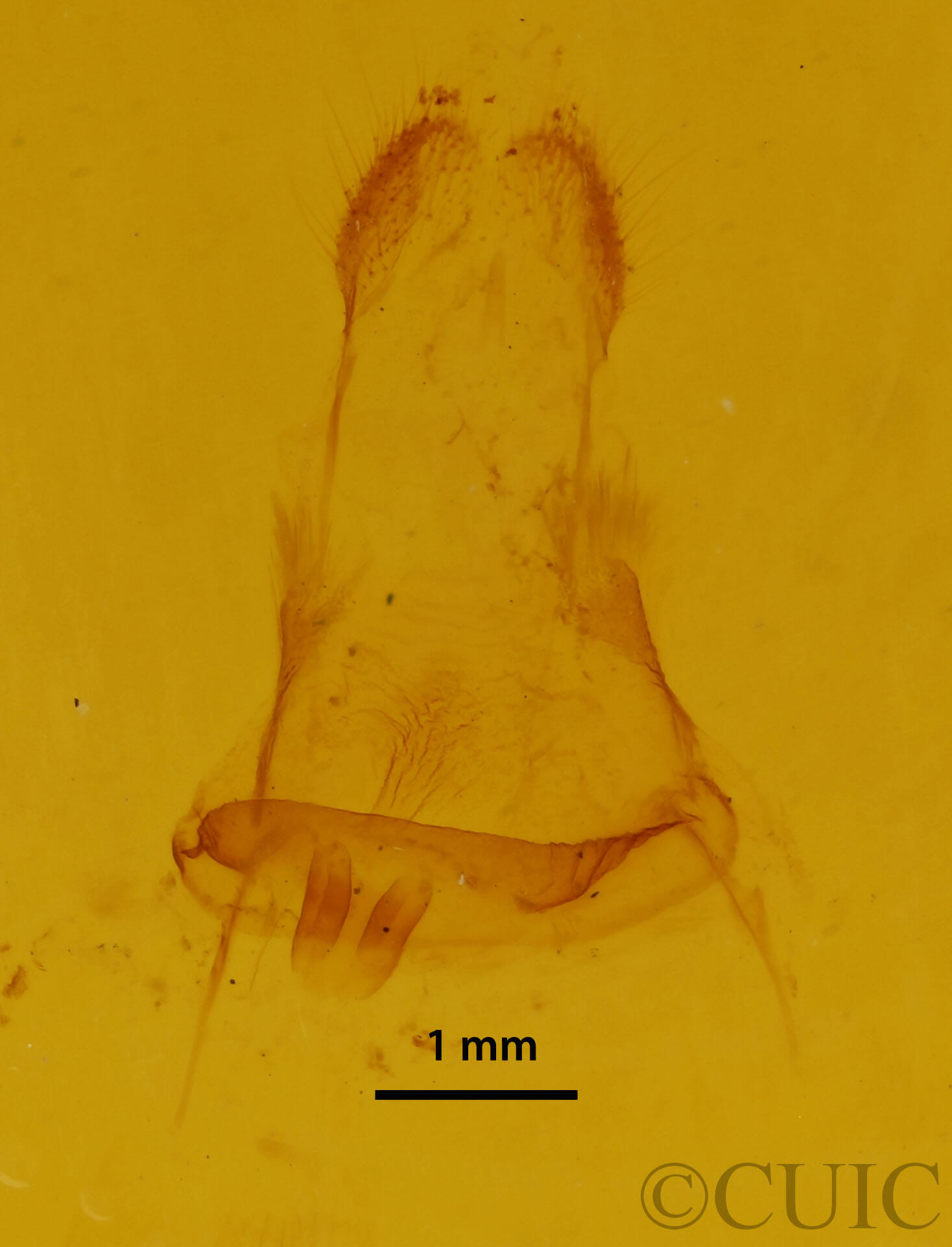 genitalia view of adult Metarranthis hypochraria