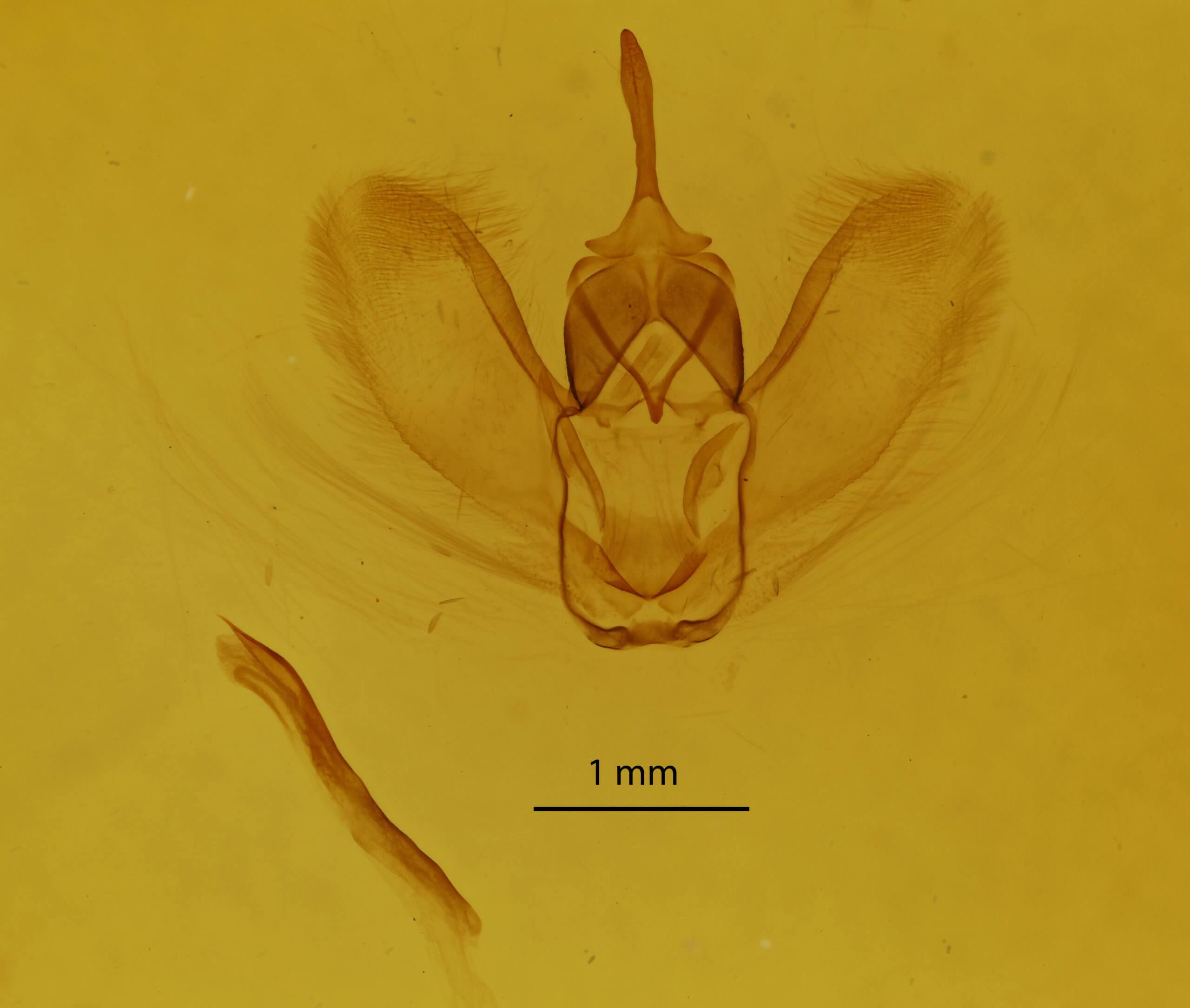 genitalia view of adult Metarranthis obfirmaria