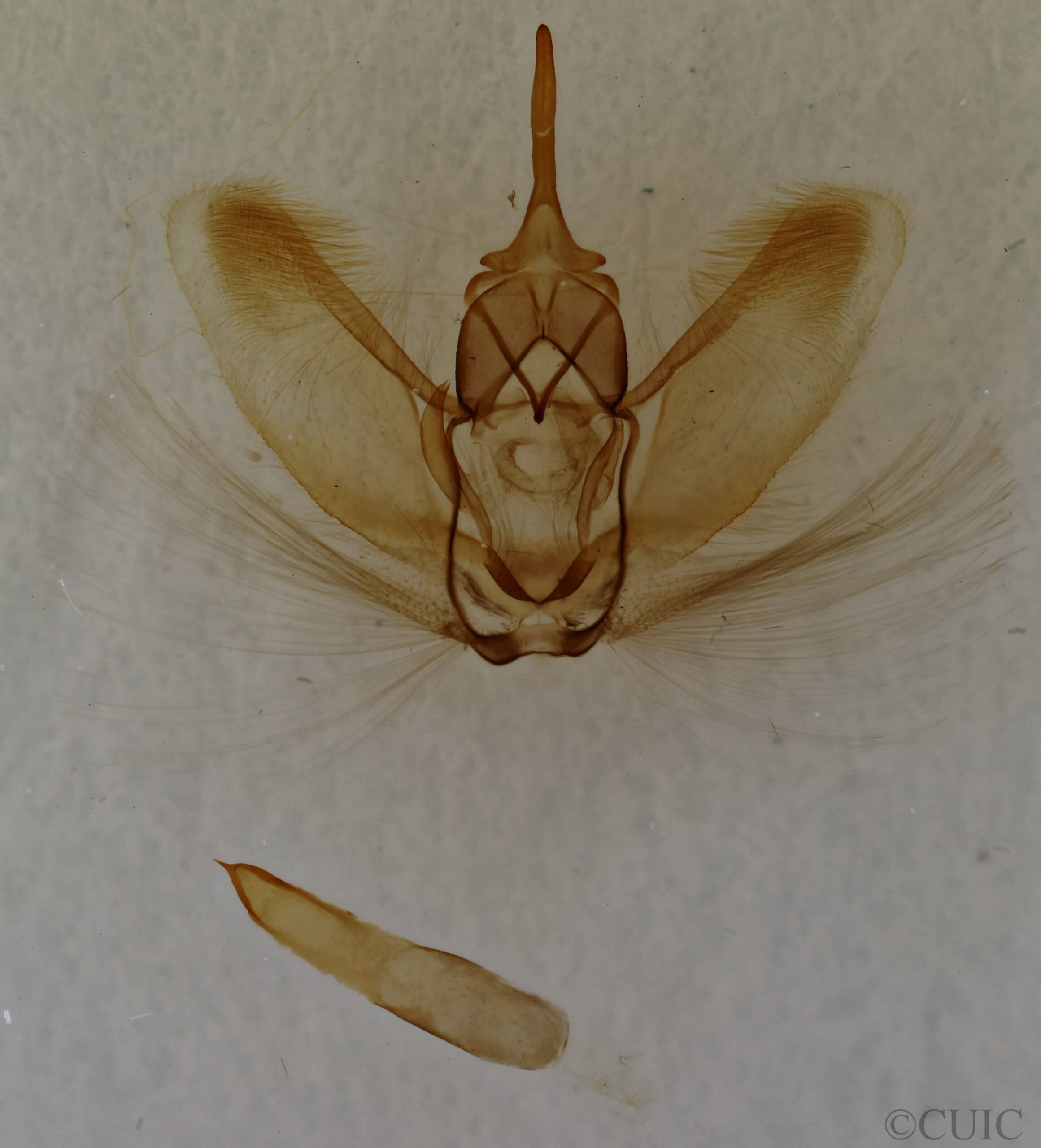 genitalia view of adult Metarranthis obfirmaria