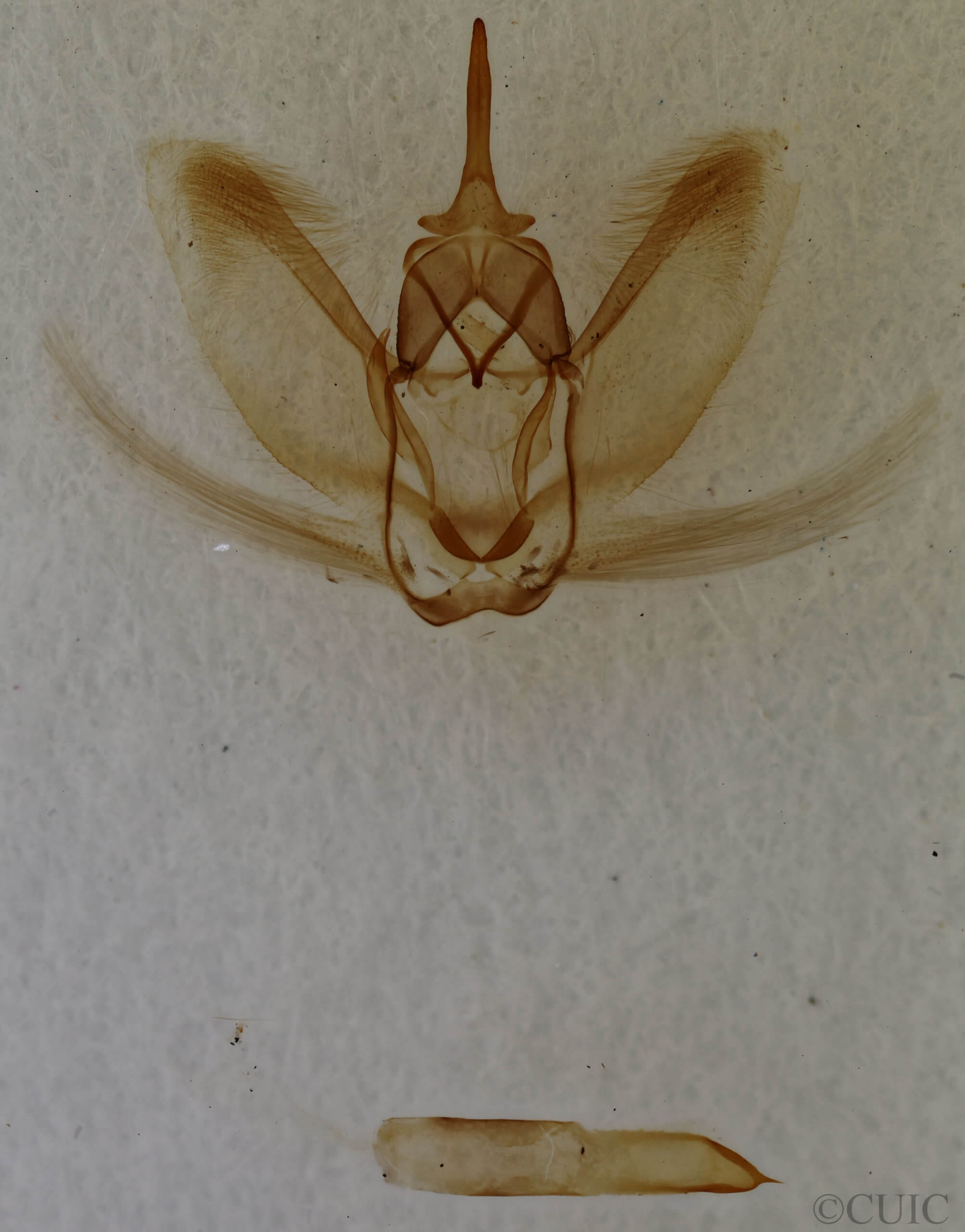 genitalia view of adult Metarranthis obfirmaria