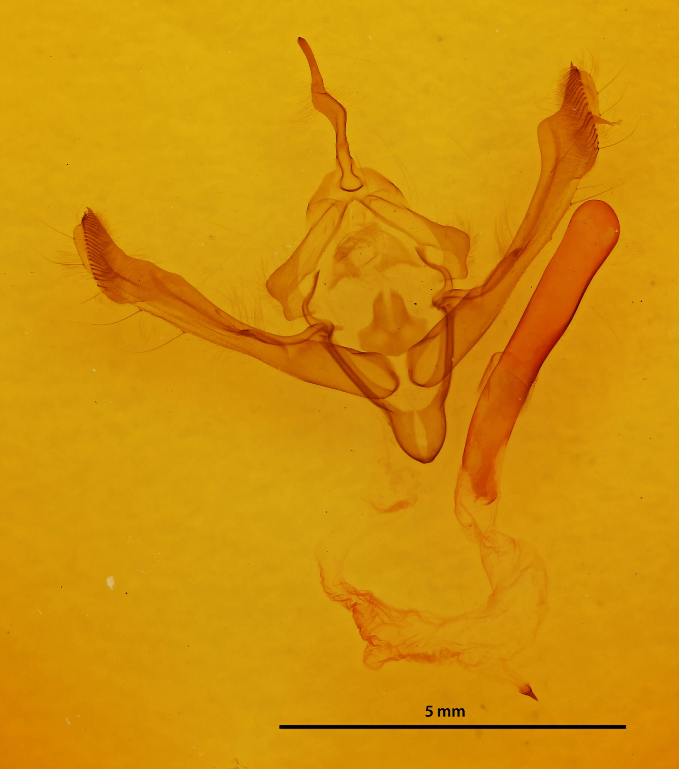 genitalia view of adult Metaxaglaea inulta