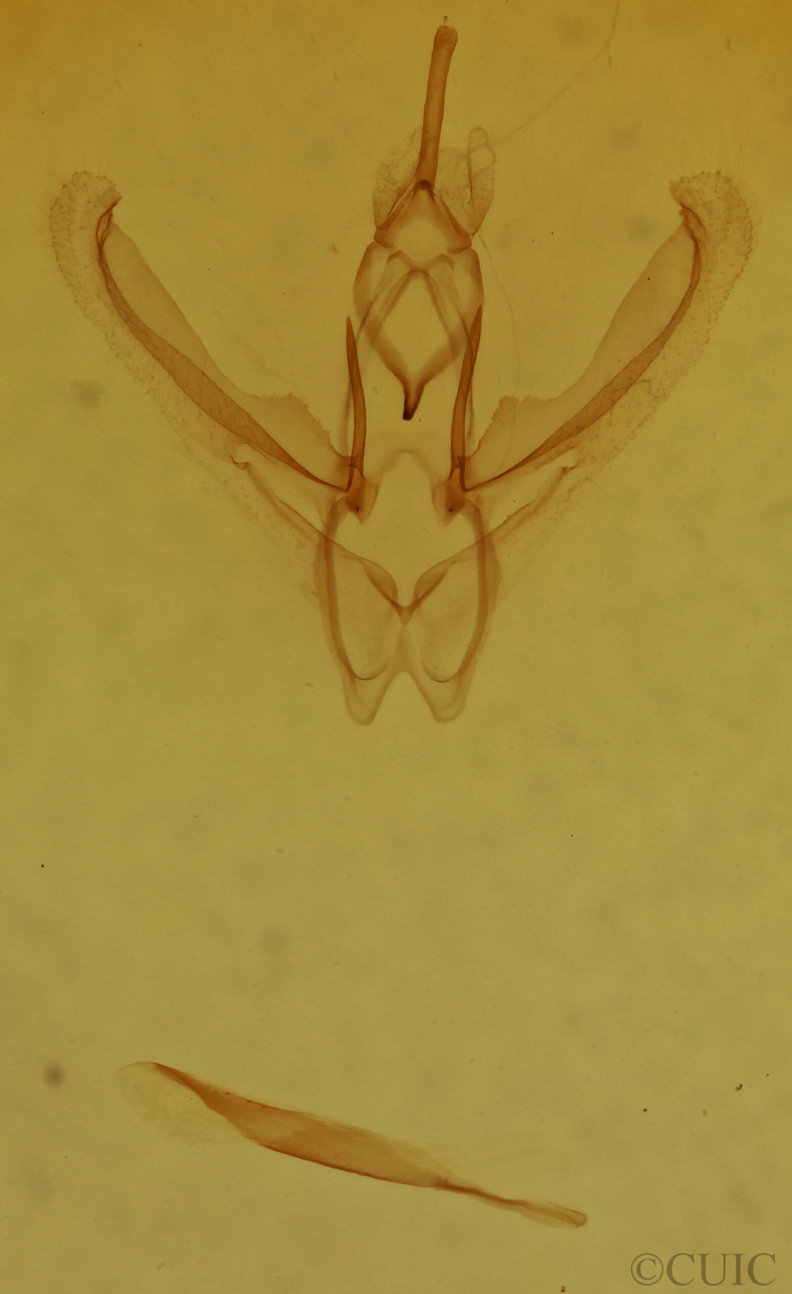 genitalia view of adult Nemoria rubrifrontaria