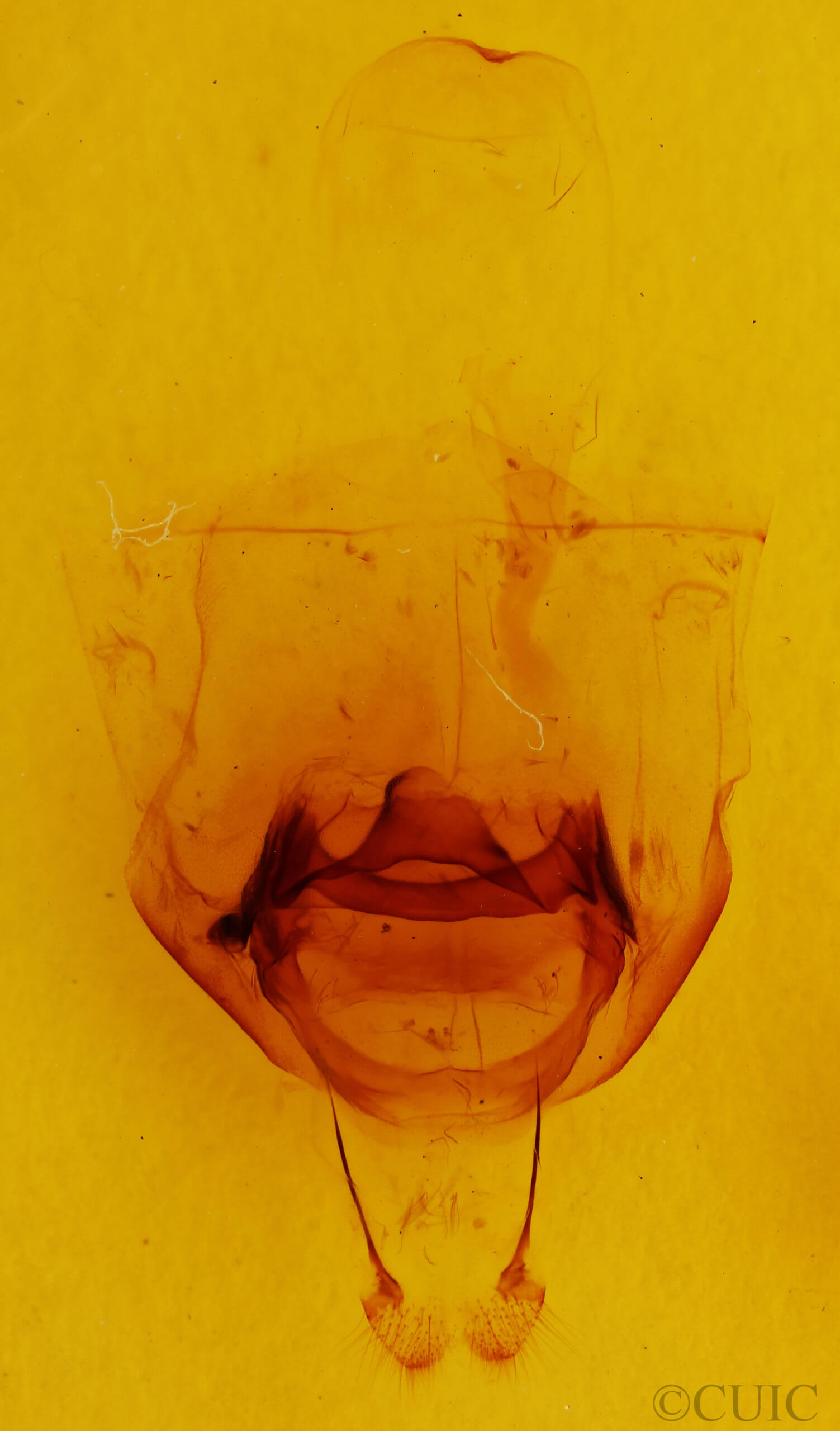 genitalia view of adult Nerice leechi