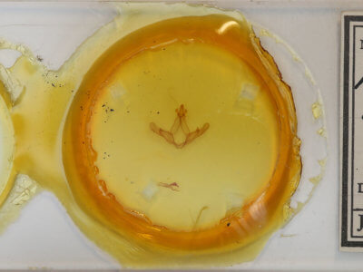 slide view of adult Nerice upina