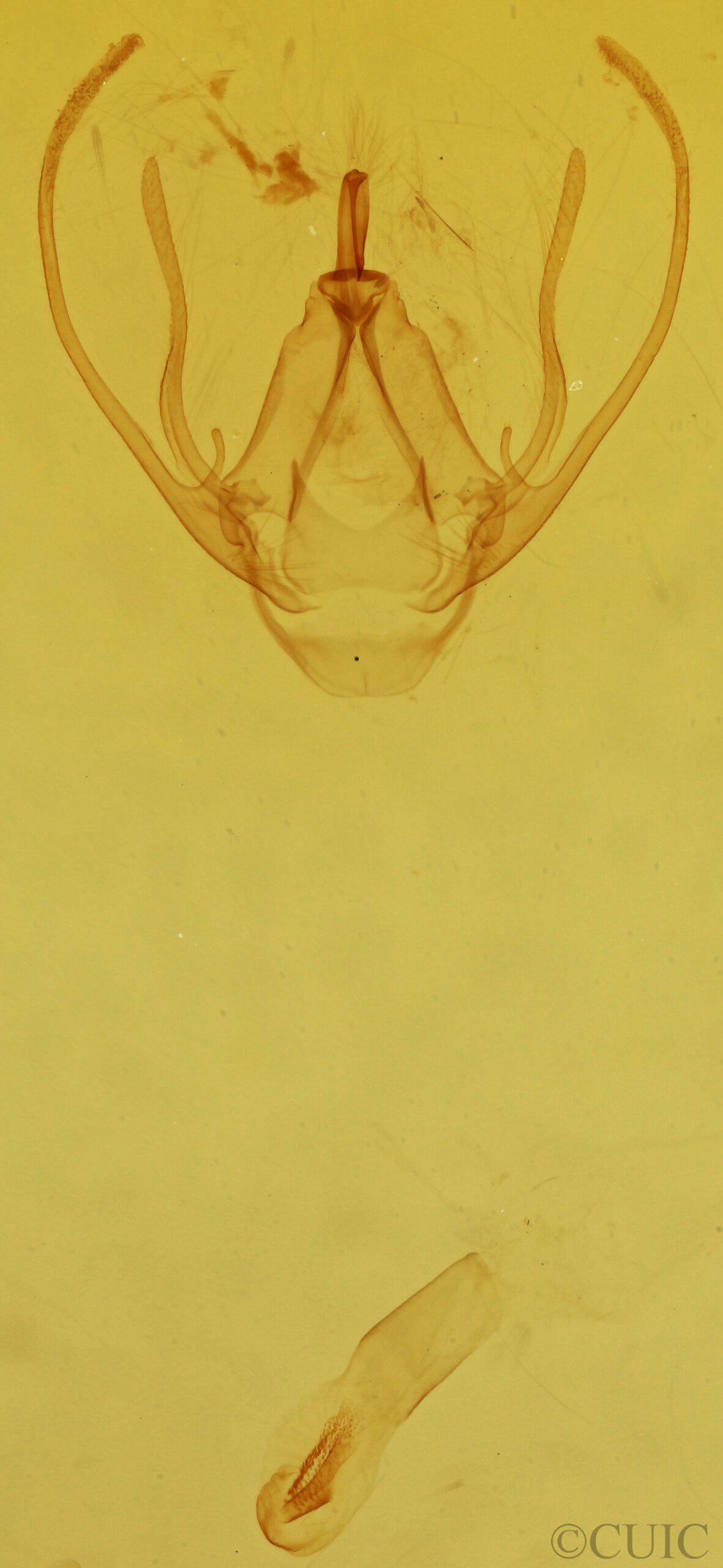 genitalia view of adult Gyrtona polionota