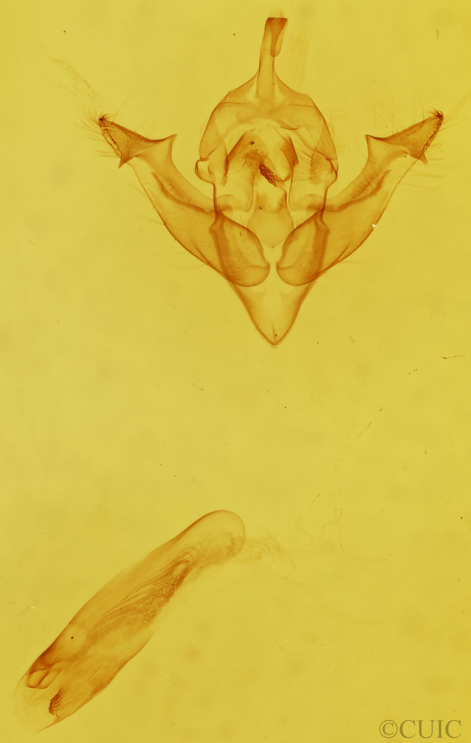 genitalia view of adult Nonagria