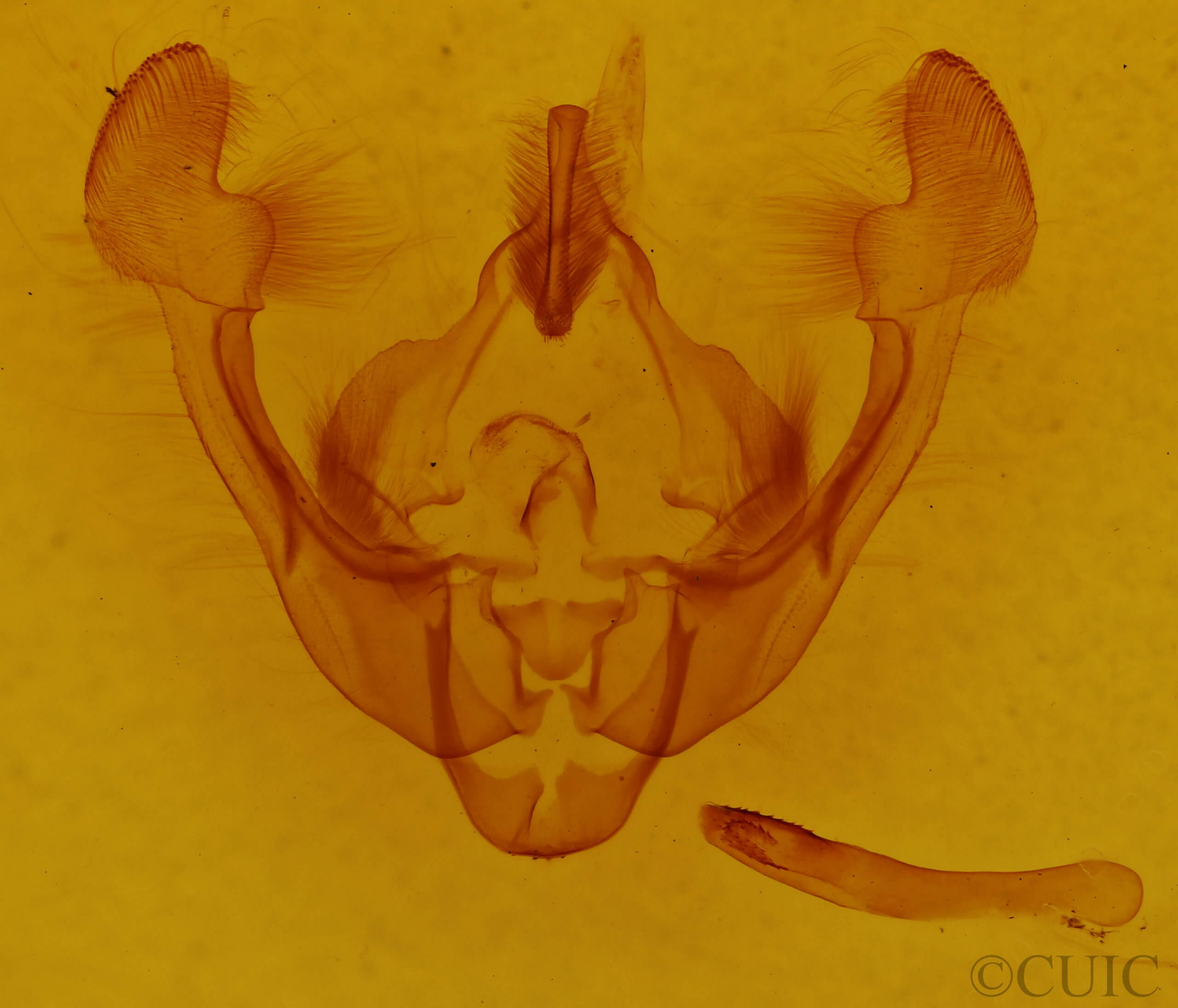 genitalia view of adult Globia sparganii