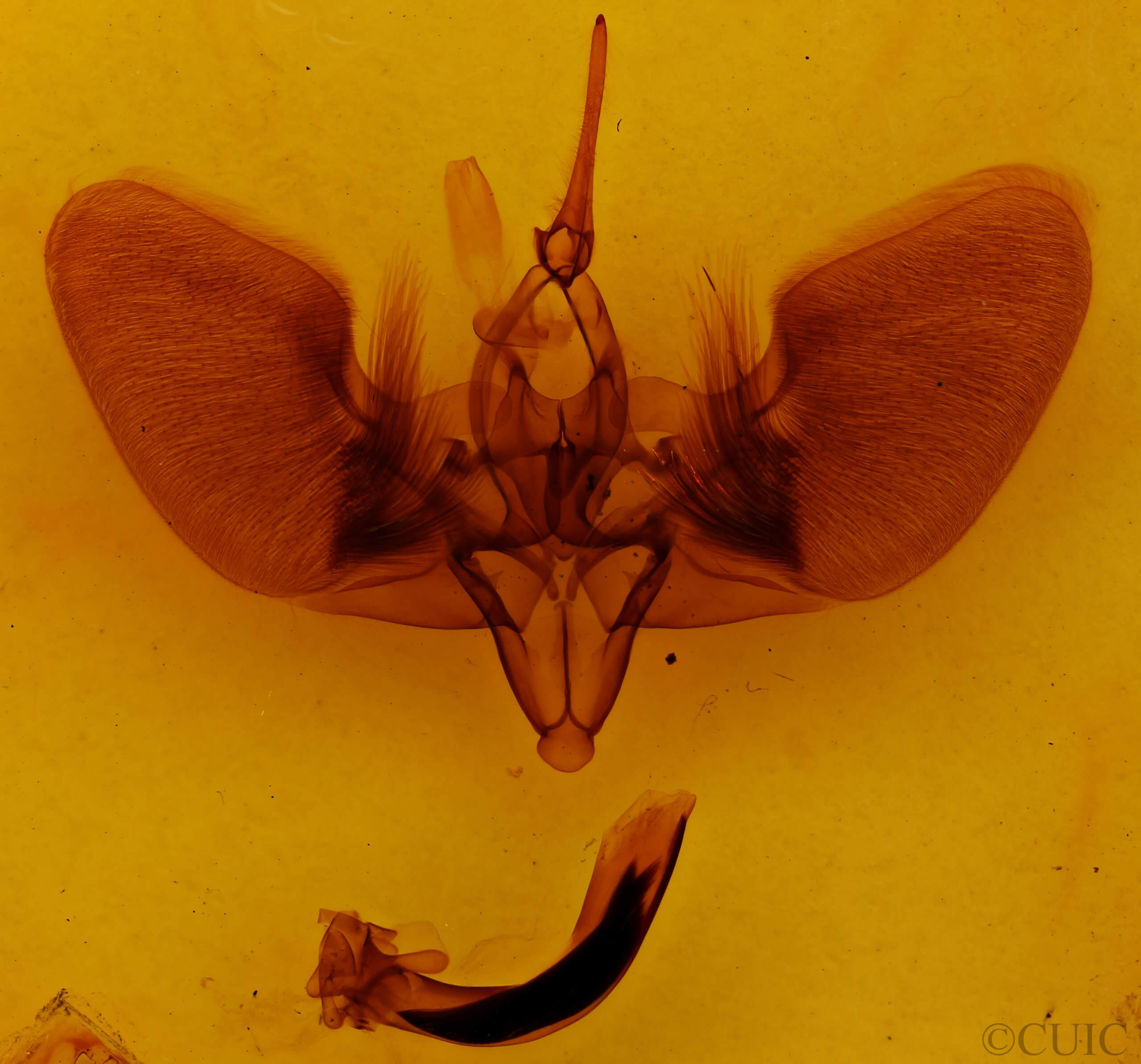 genitalia view of adult Lyssa zampa