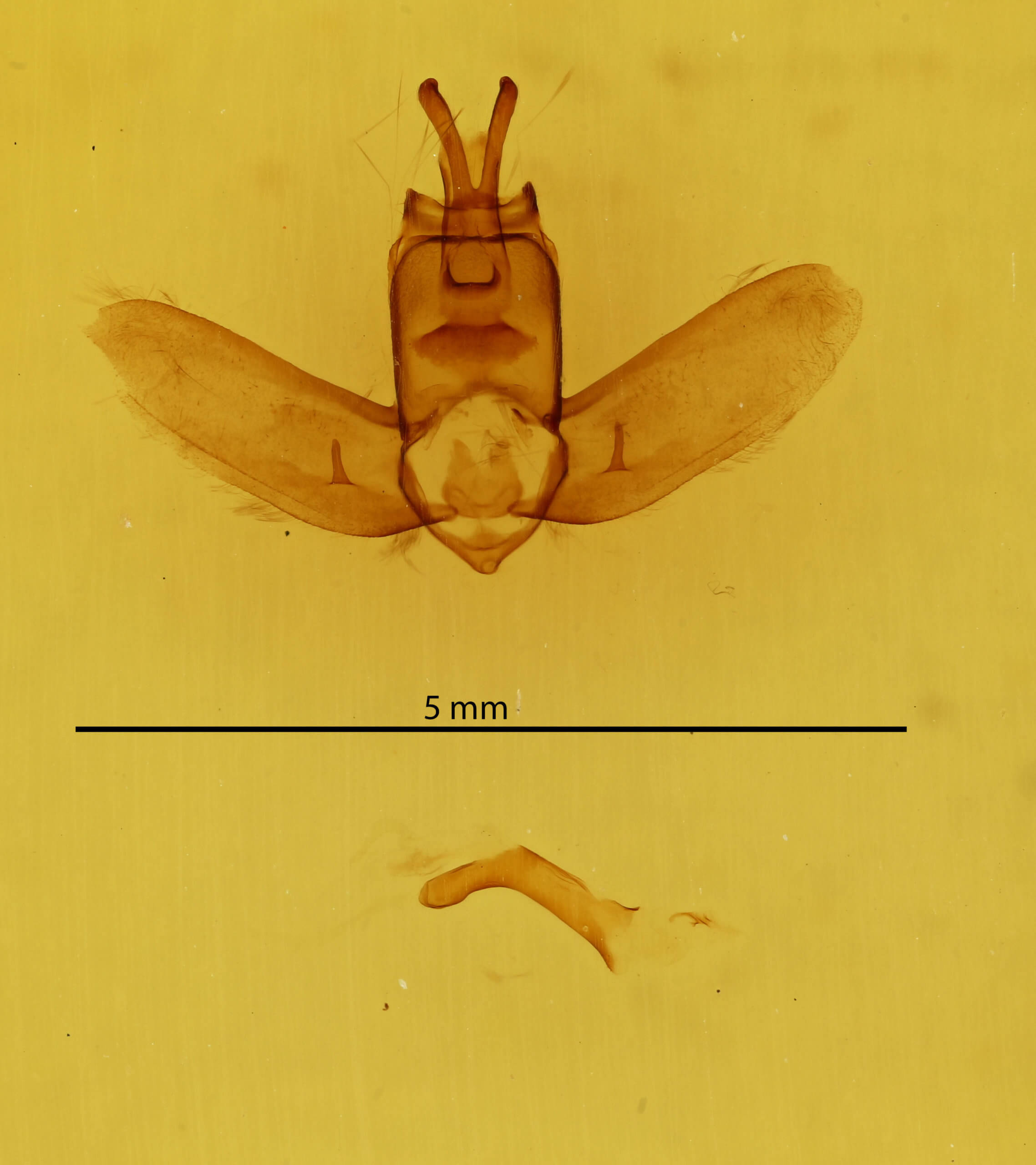 genitalia view of adult Olceclostera