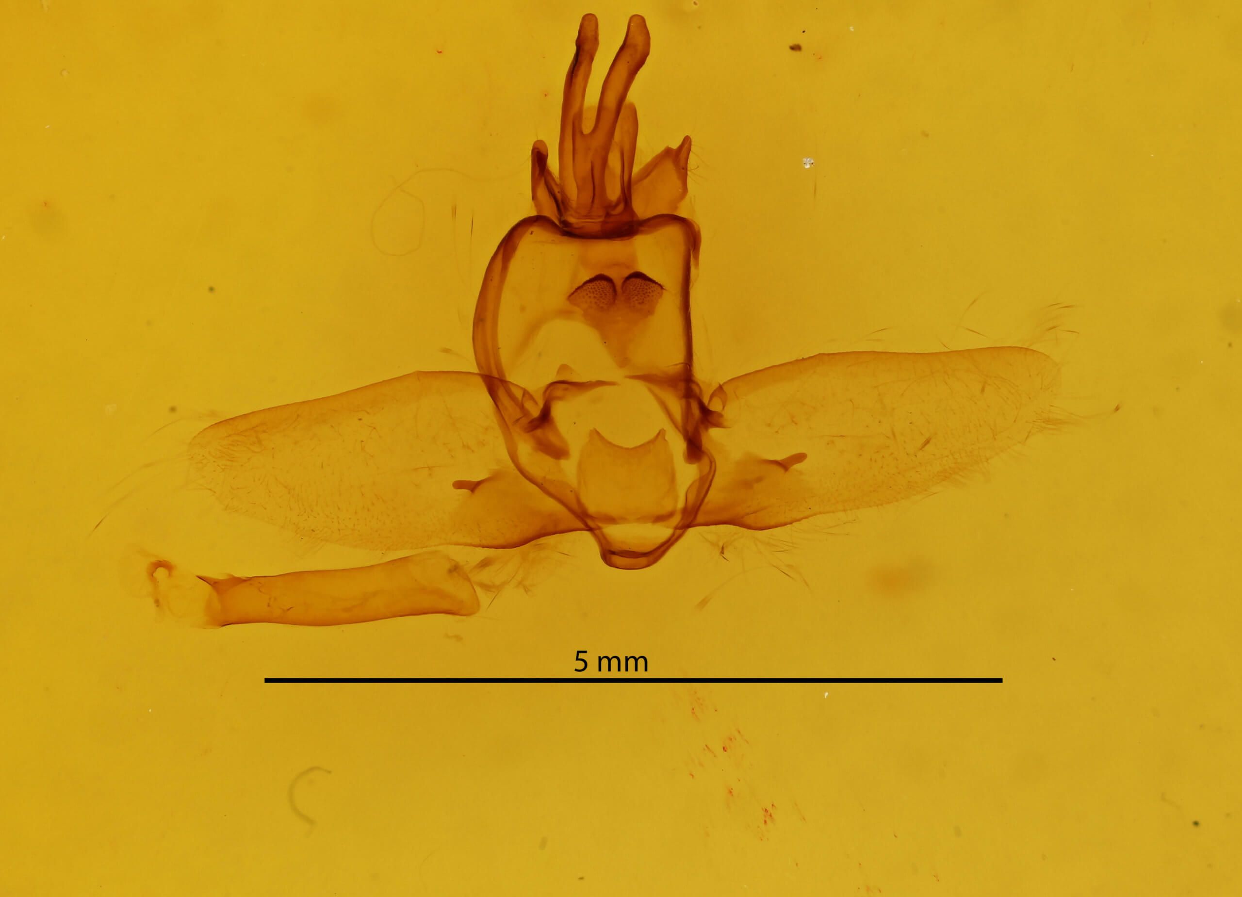 genitalia view of adult Olceclostera