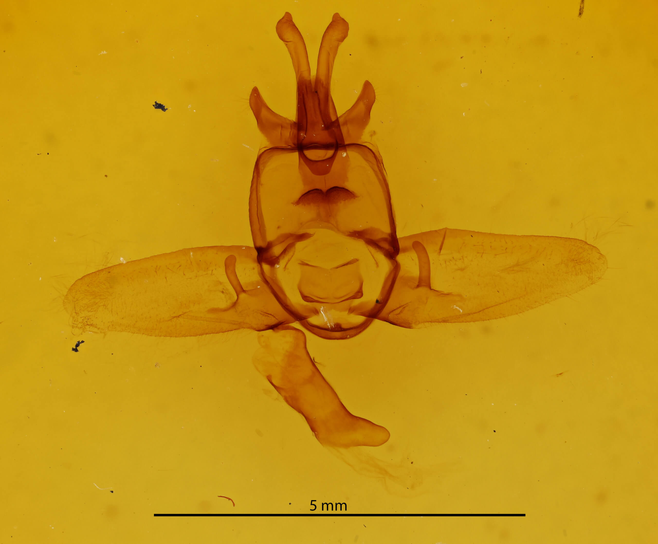 genitalia view of adult Olceclostera