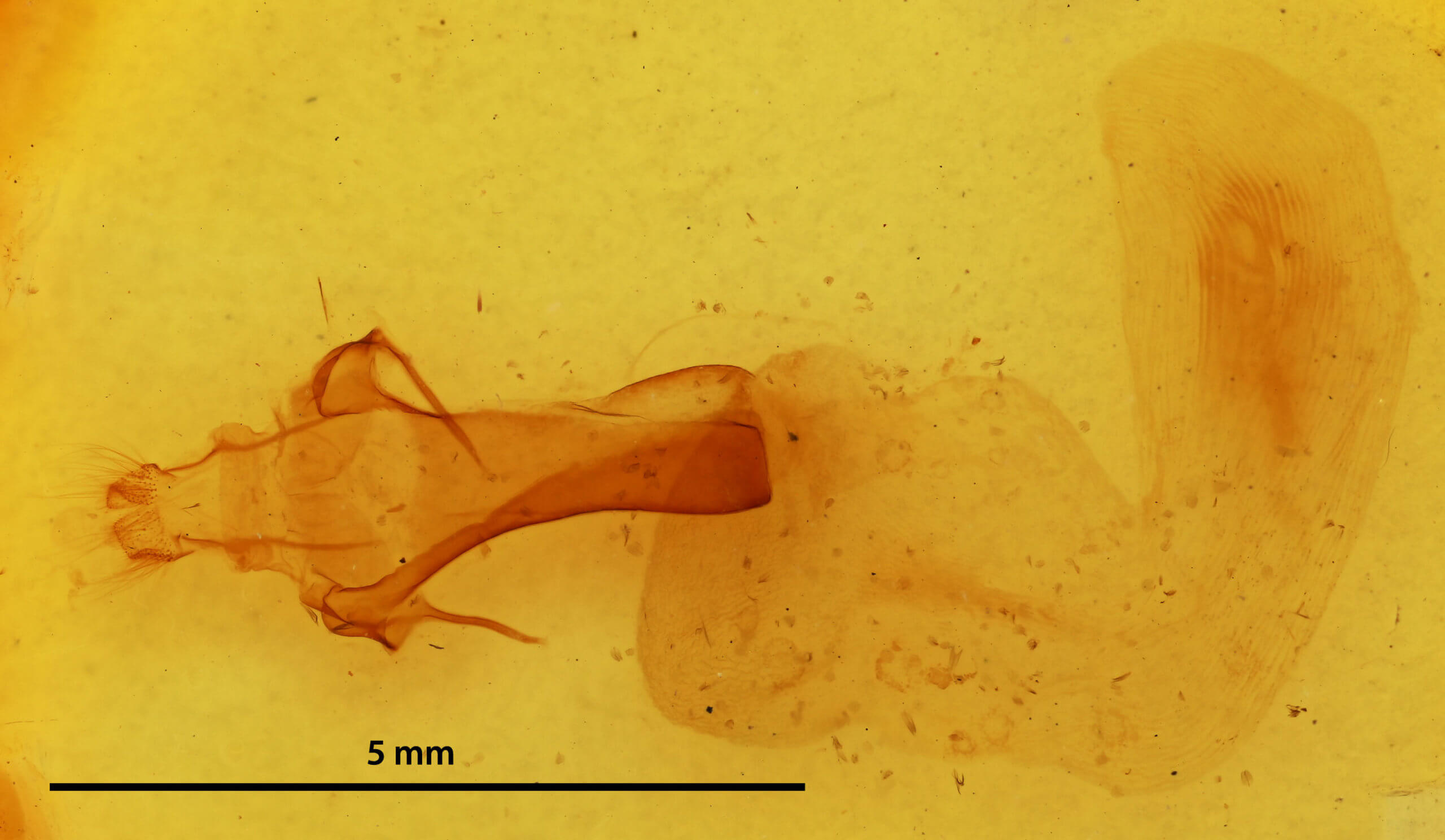 genitalia view of adult Orbona fragariae