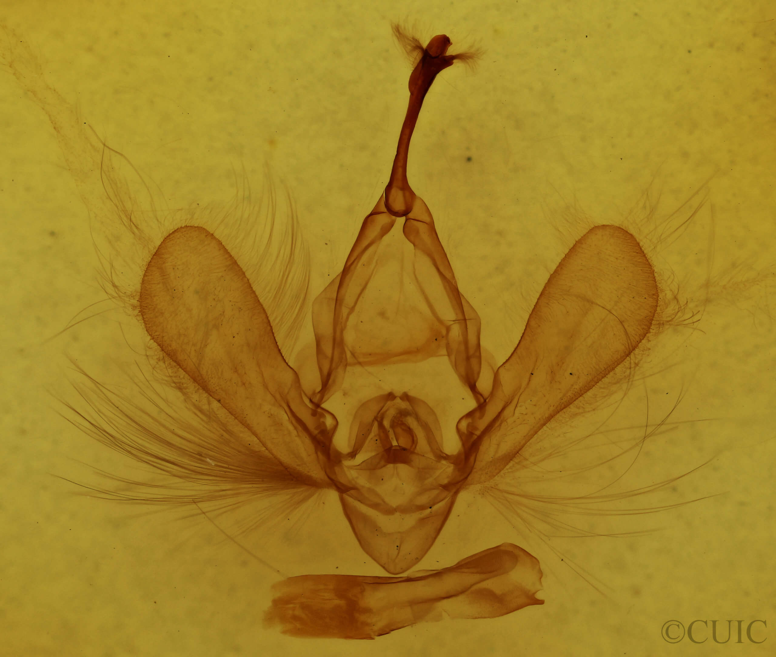 genitalia view of adult Panopoda carneicosta