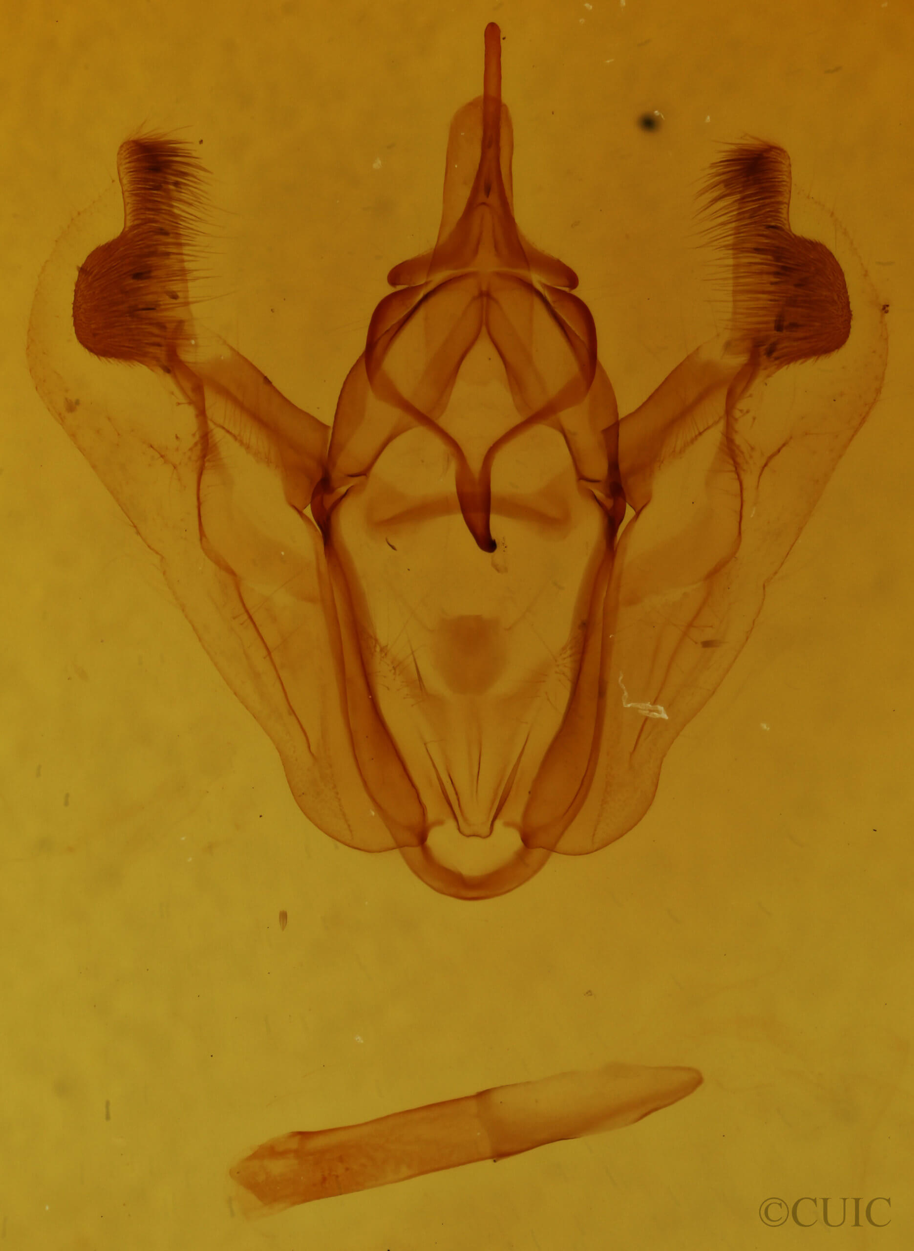 genitalia view of adult Pero