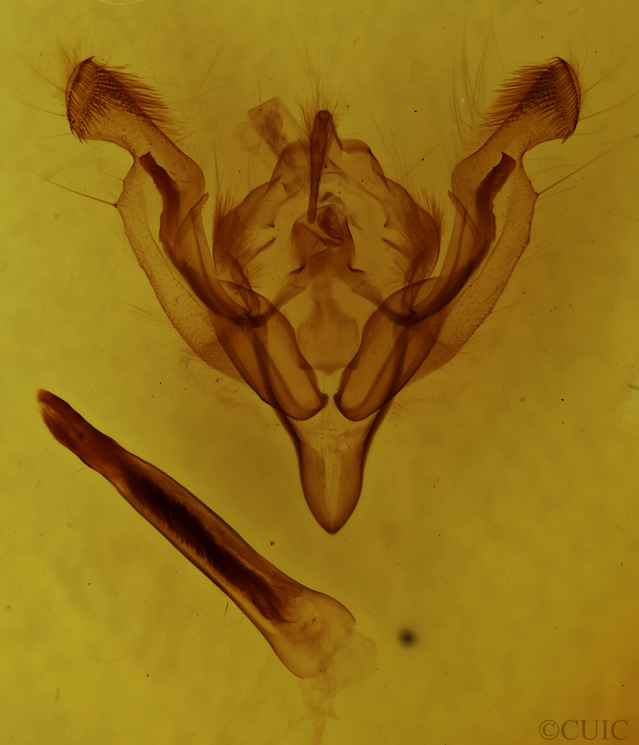 genitalia view of adult Ichneutica arotica