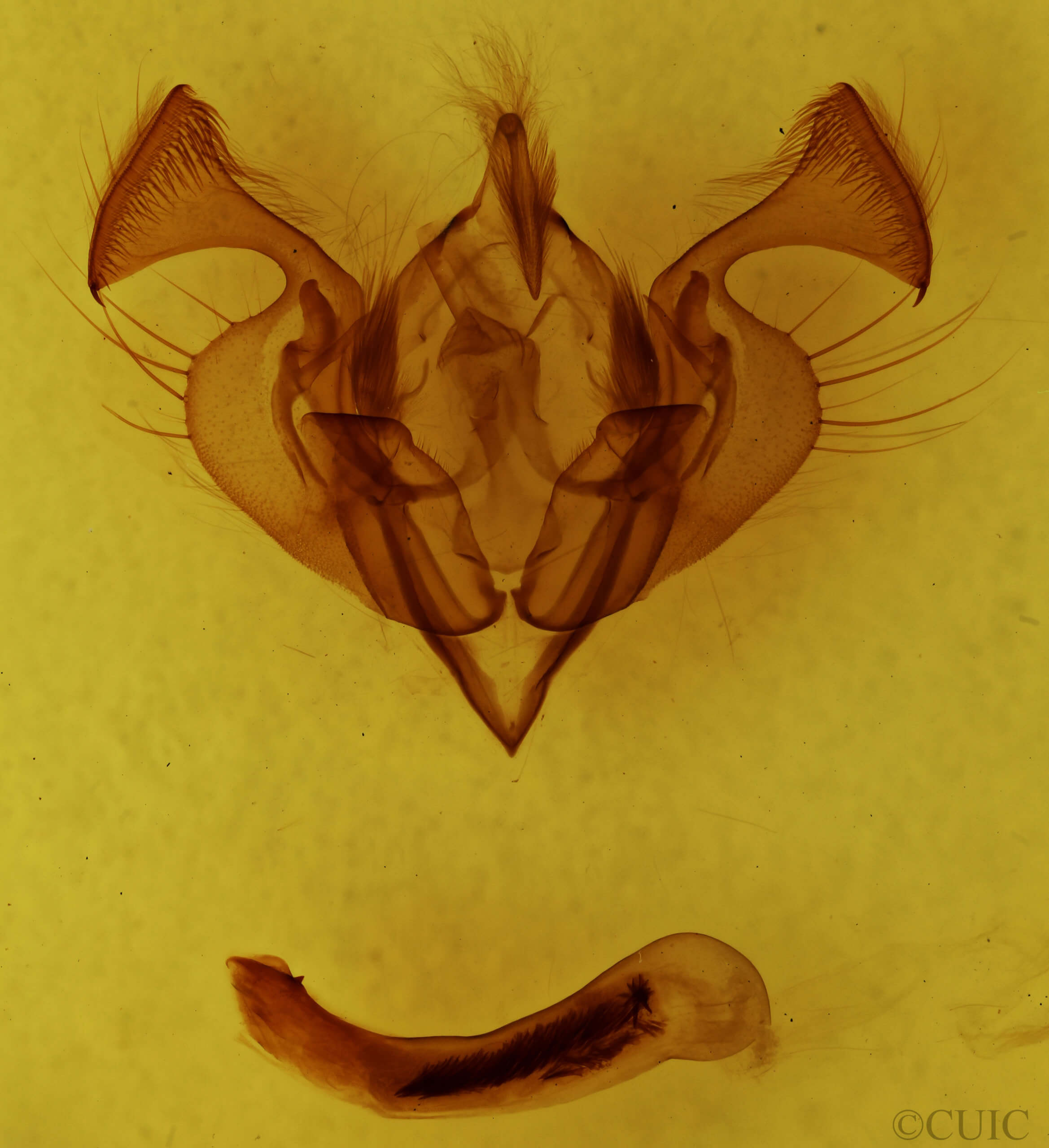 genitalia view of adult Ichneutica atristriga