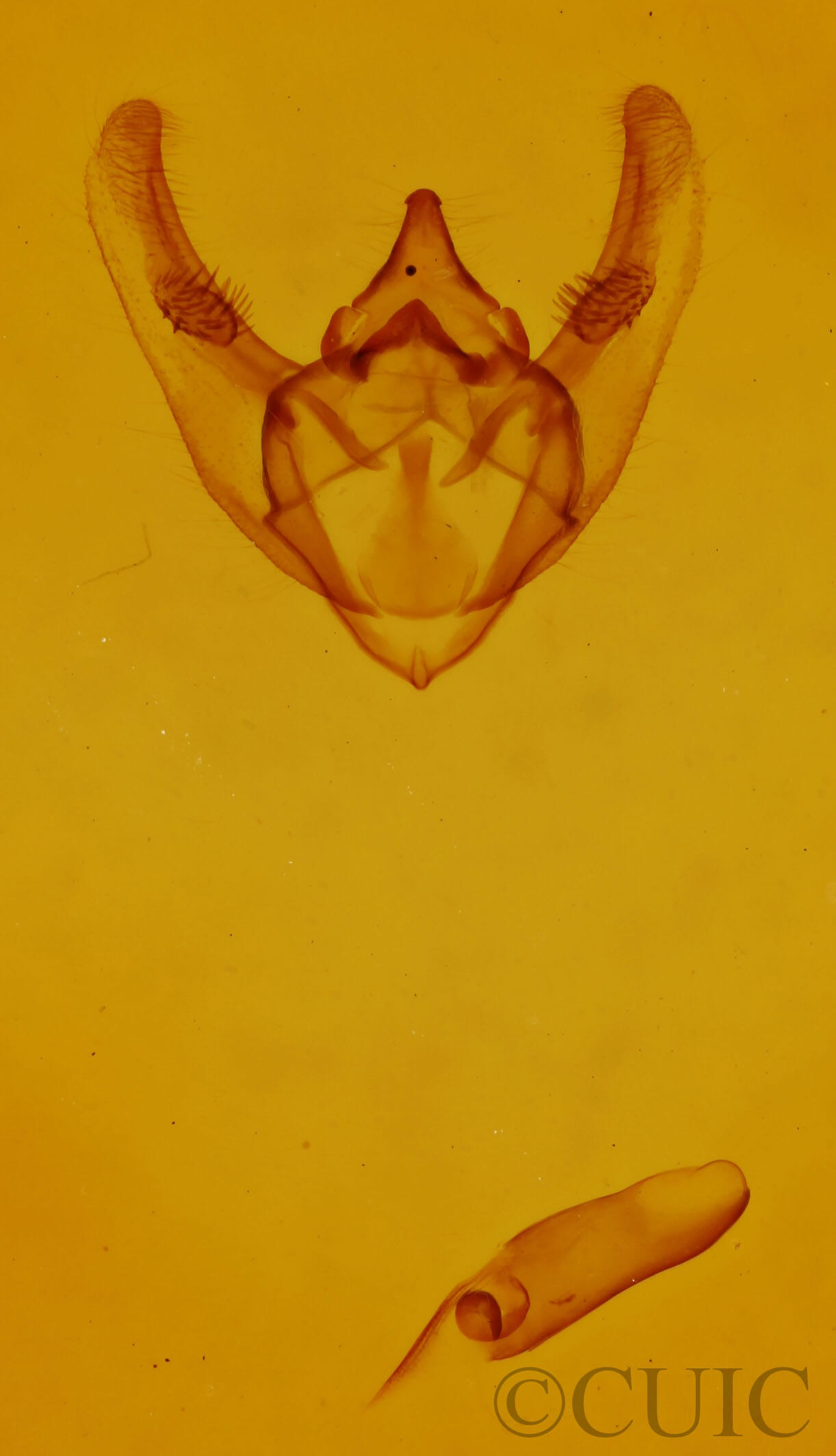 genitalia view of adult Phigalia titea