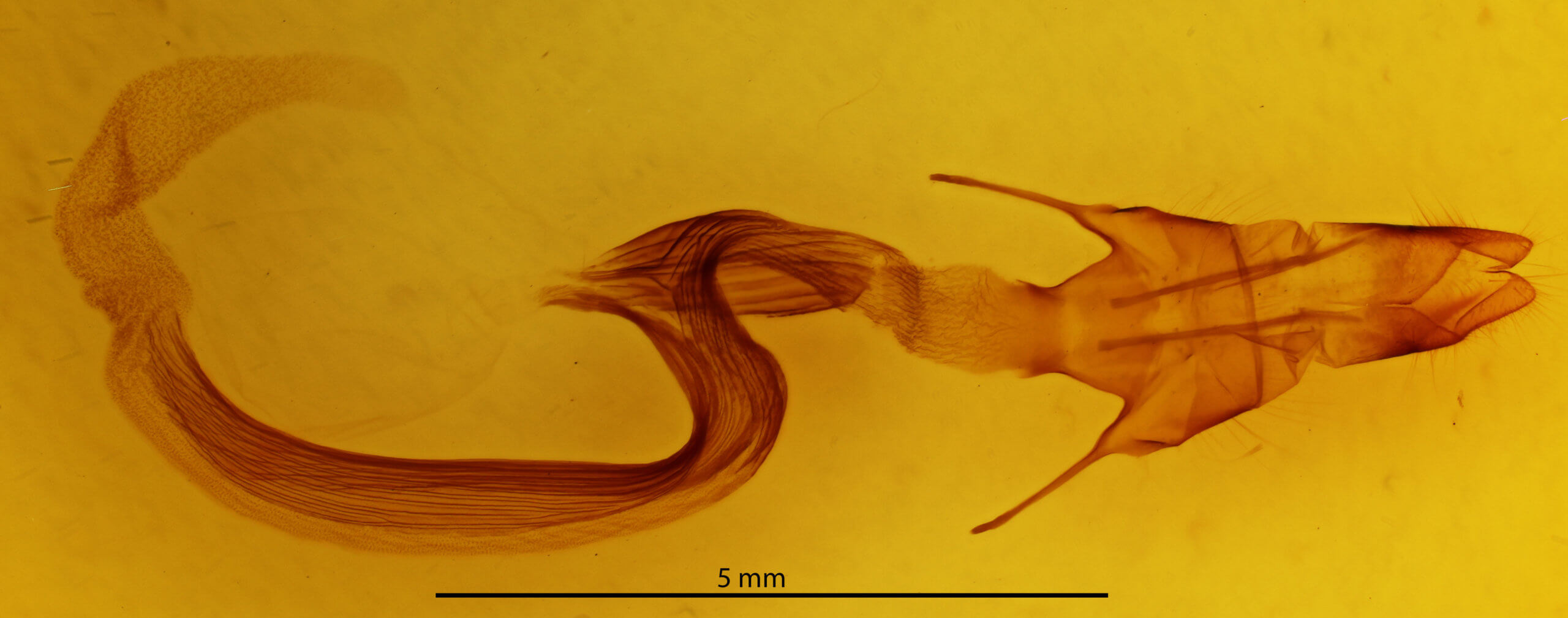genitalia view of adult Mythimna separata