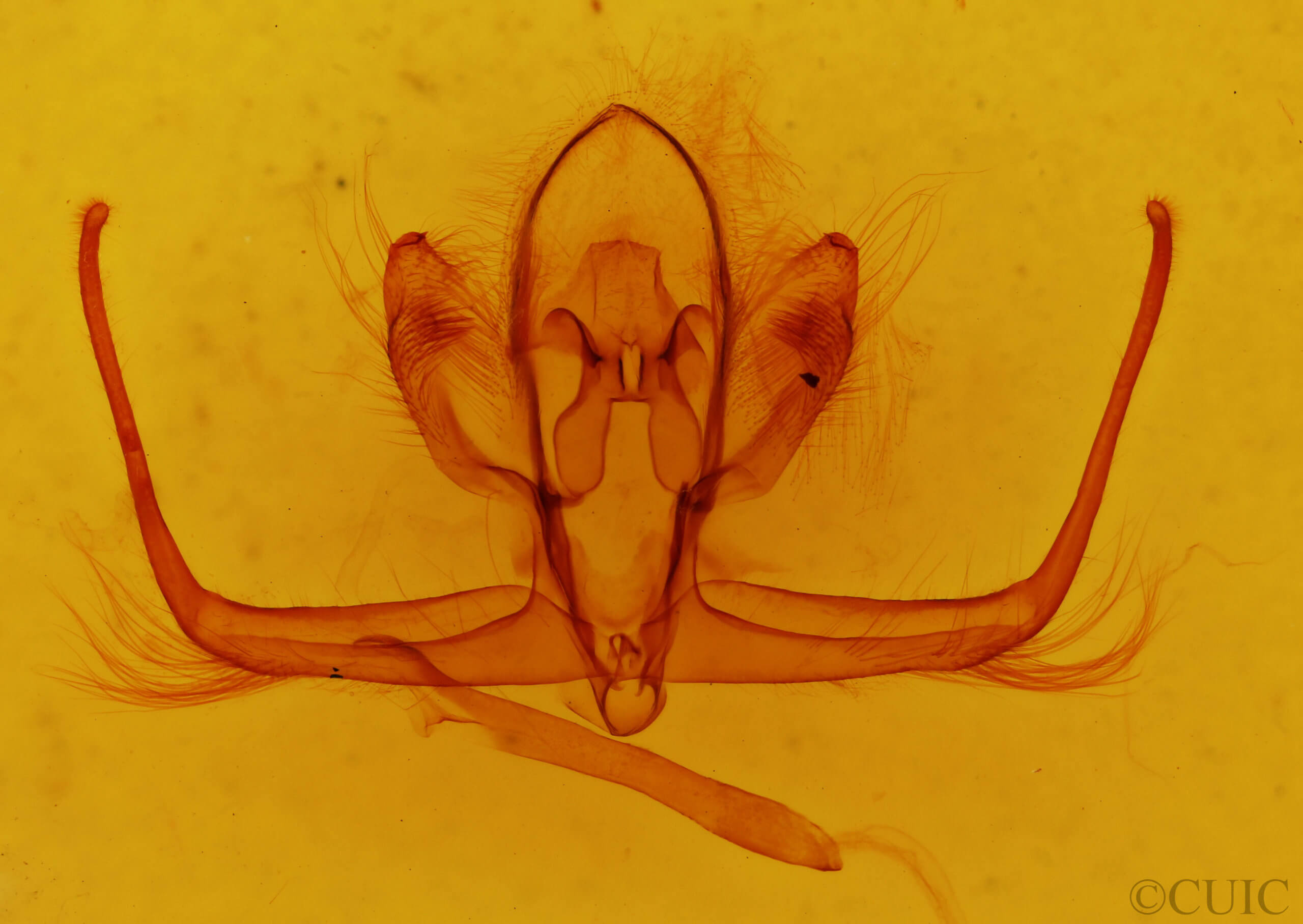 genitalia view of adult Quentalia sheila