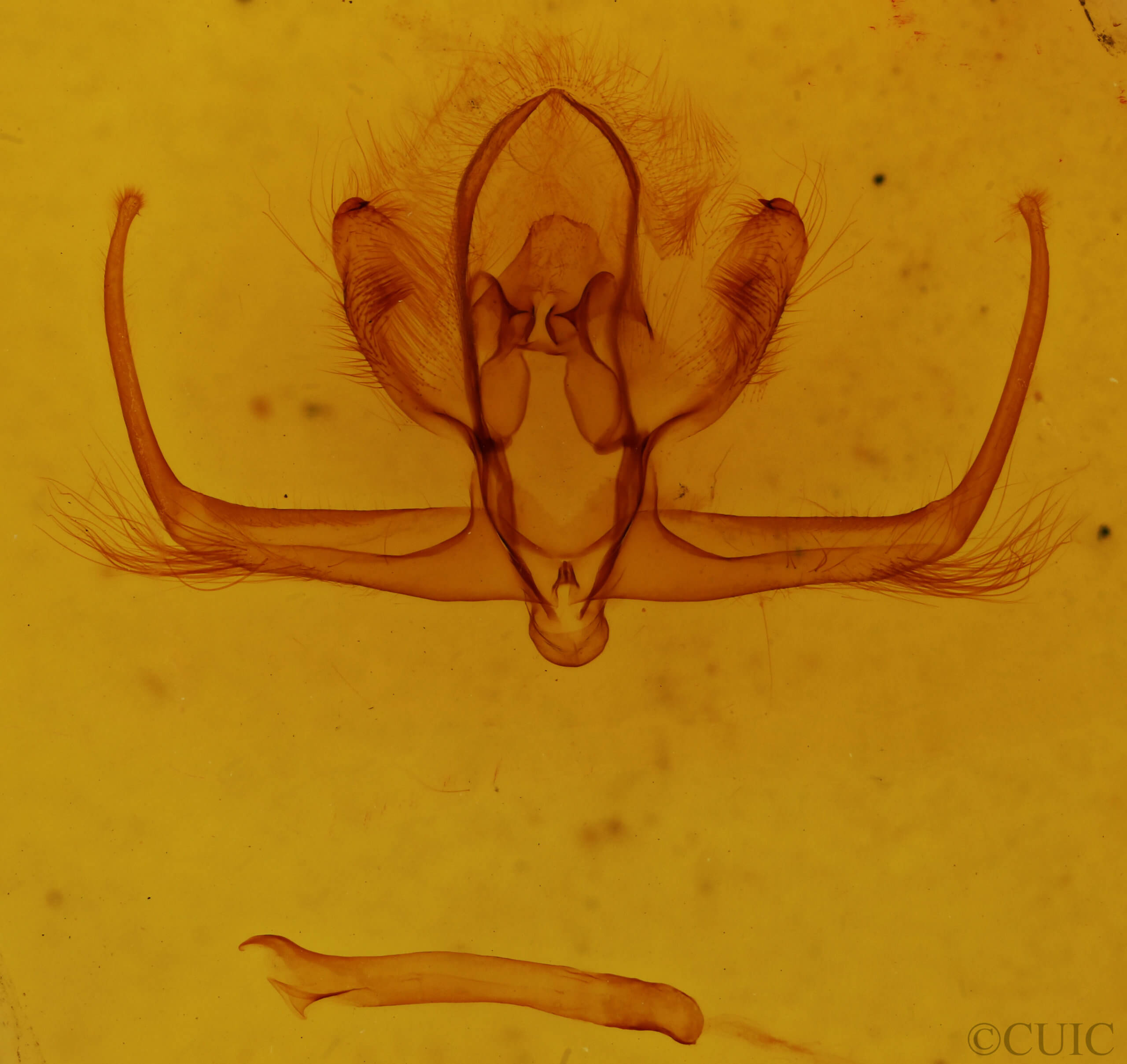 genitalia view of adult Quentalia sheila