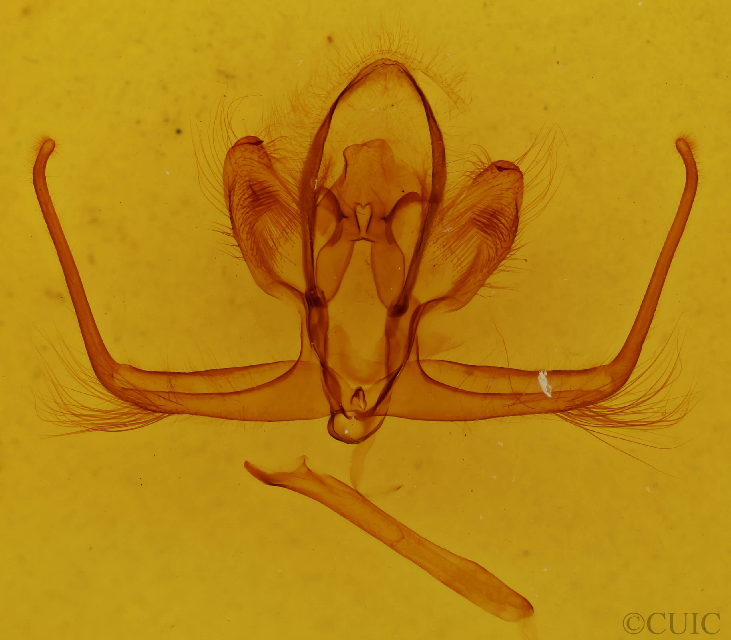 genitalia view of adult Quentalia sheila