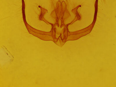 genitalia view of adult Quentalia