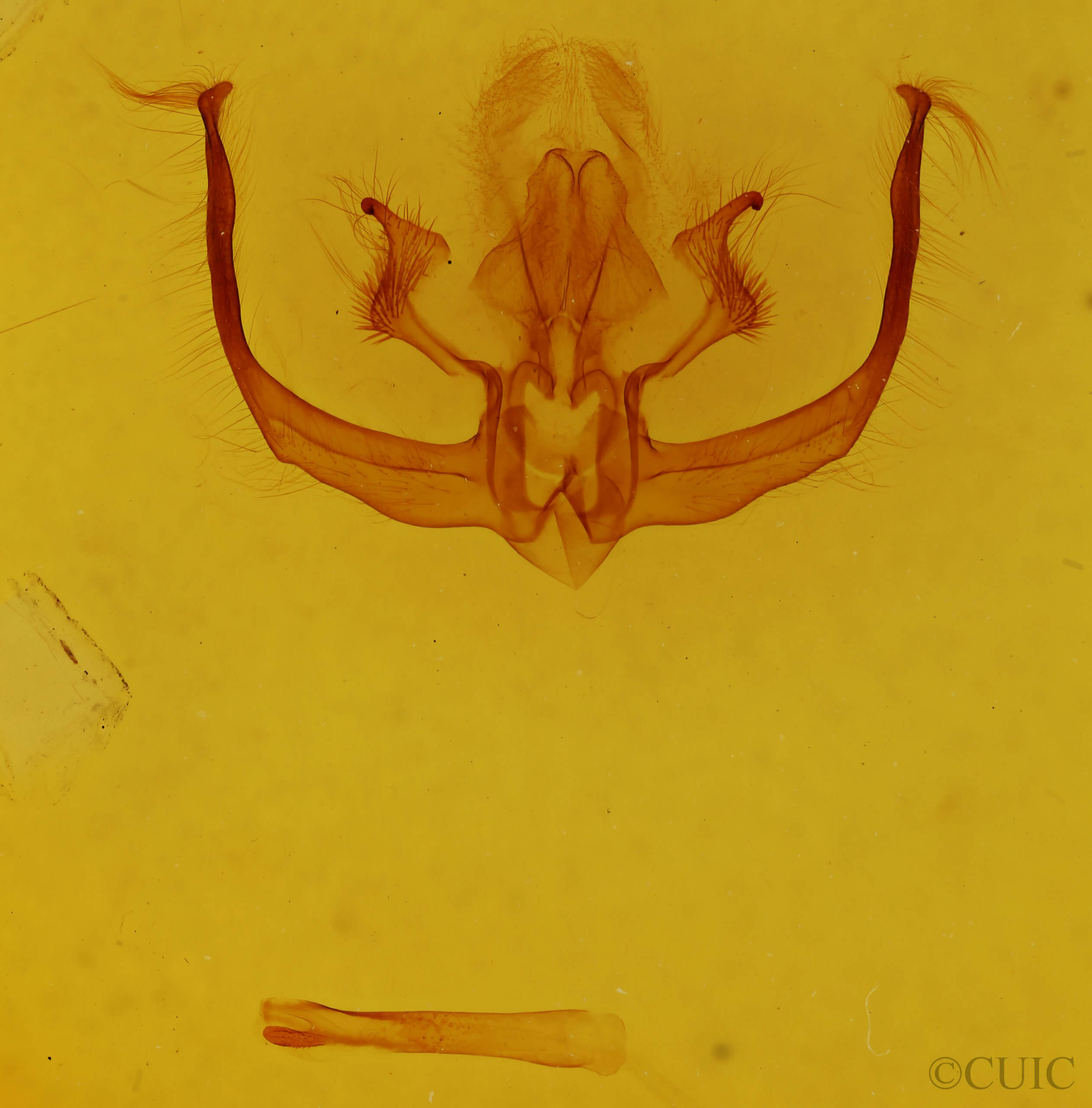 genitalia view of adult Quentalia