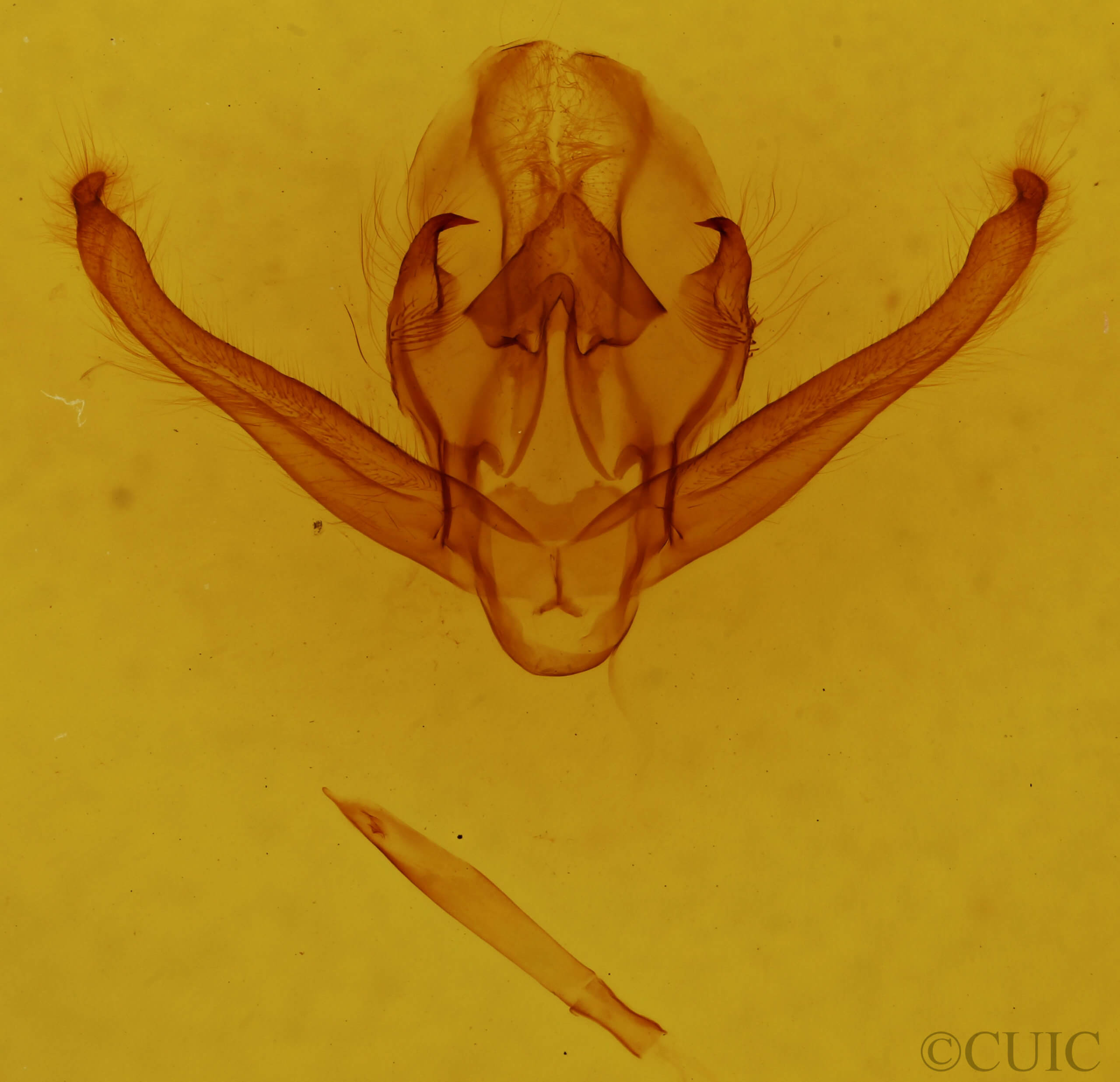 genitalia view of adult Quentalia ephonia