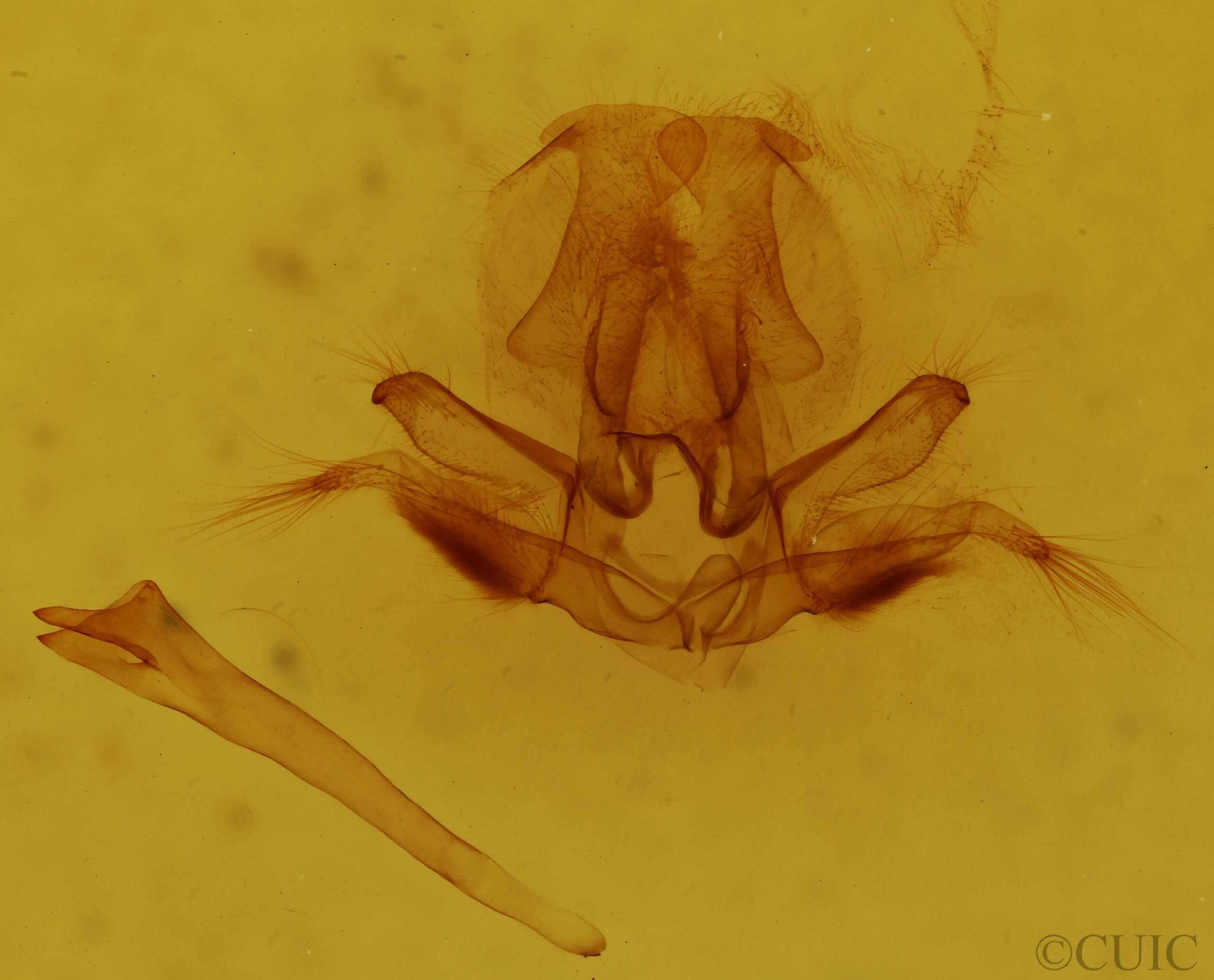 genitalia view of adult Quentalia veca