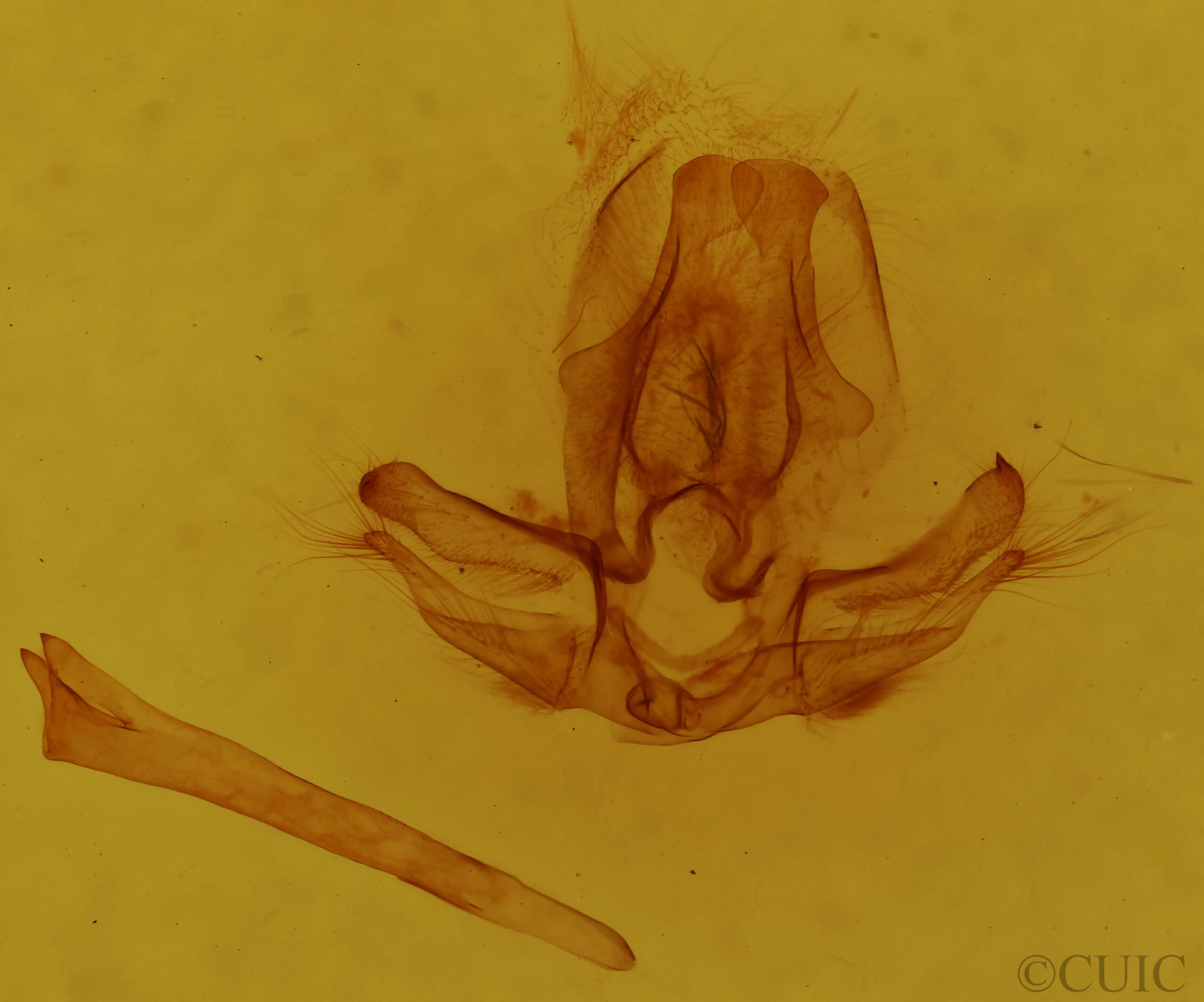 genitalia view of adult Quentalia veca