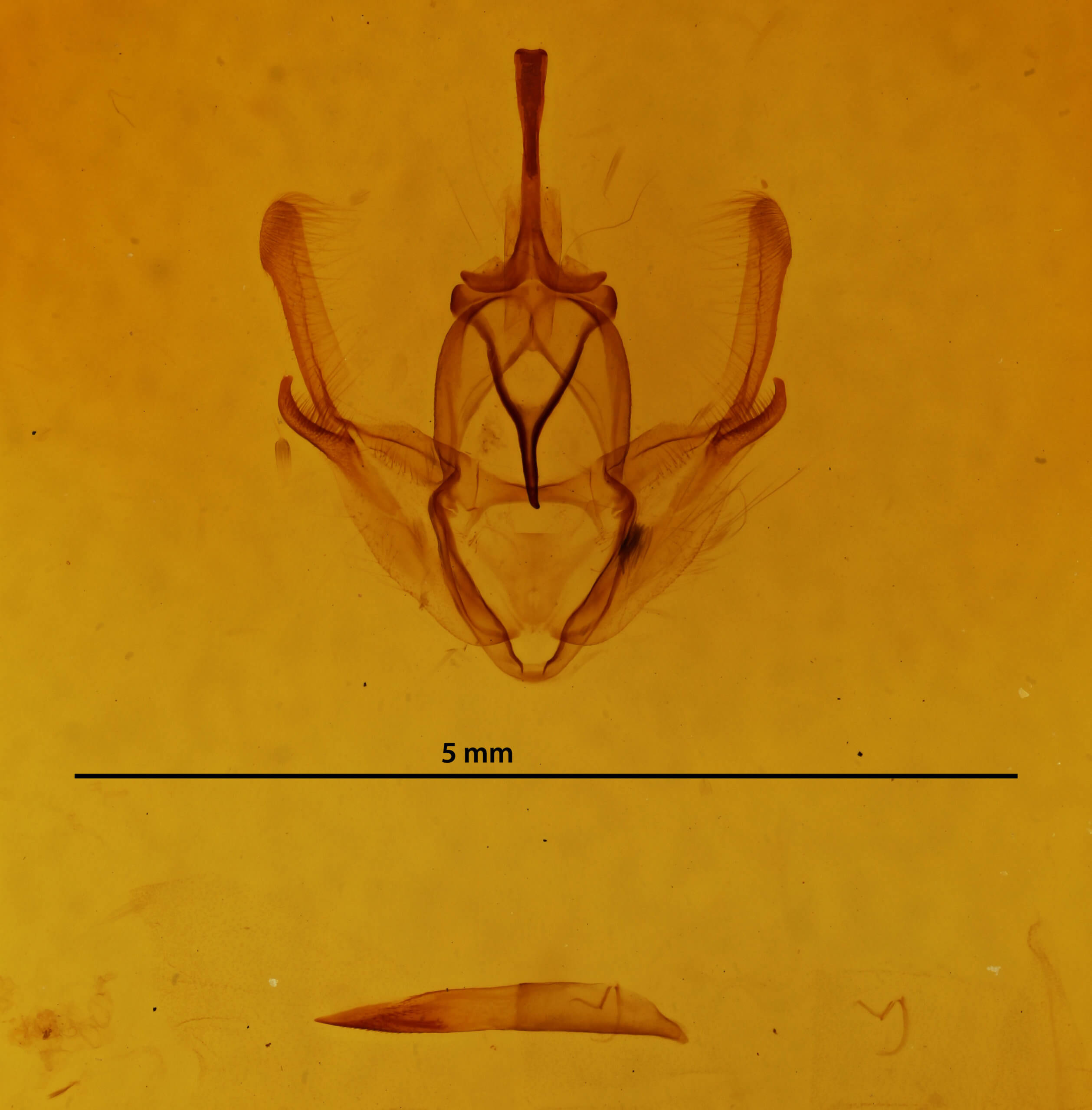 genitalia view of adult Pero