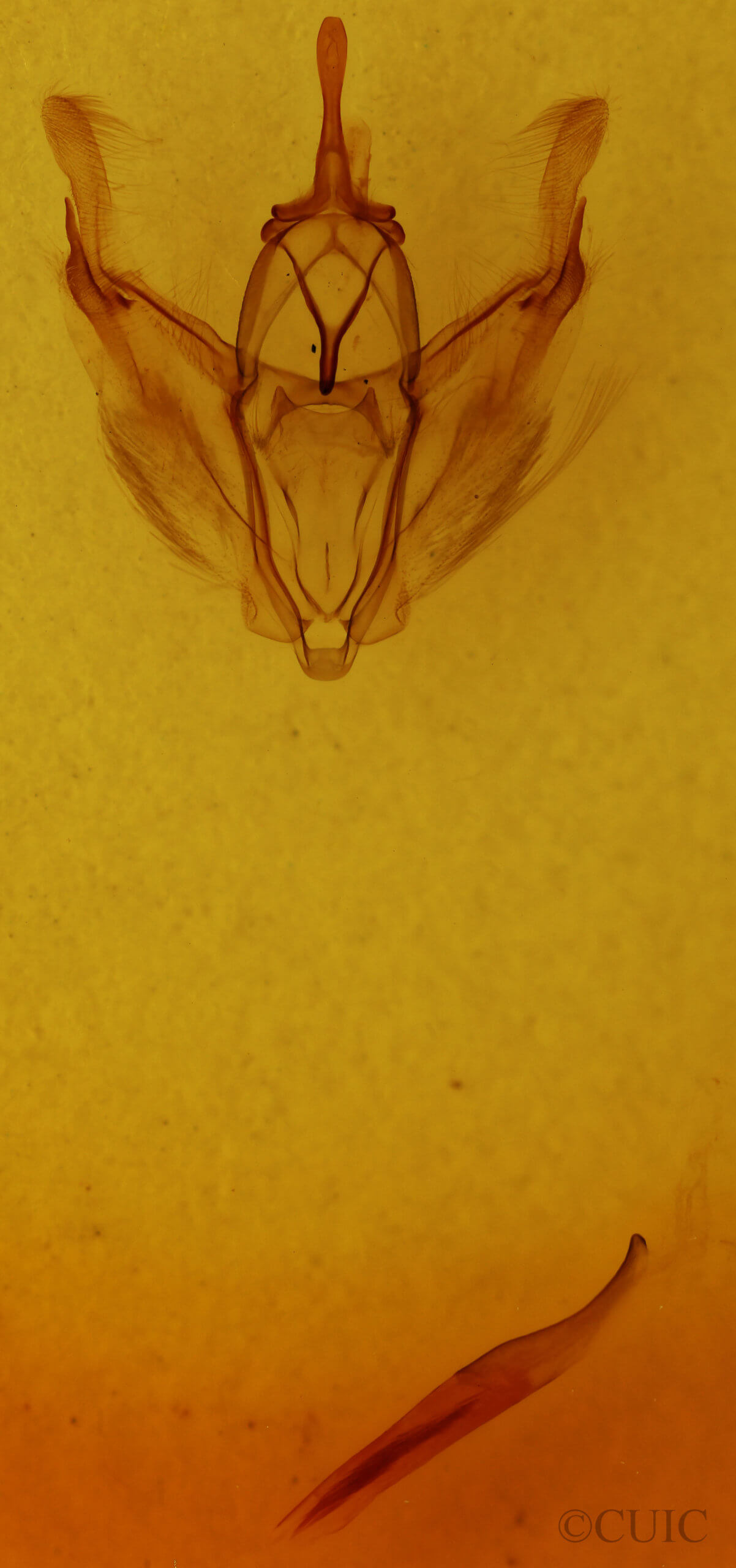 genitalia view of adult Pero radiosaria
