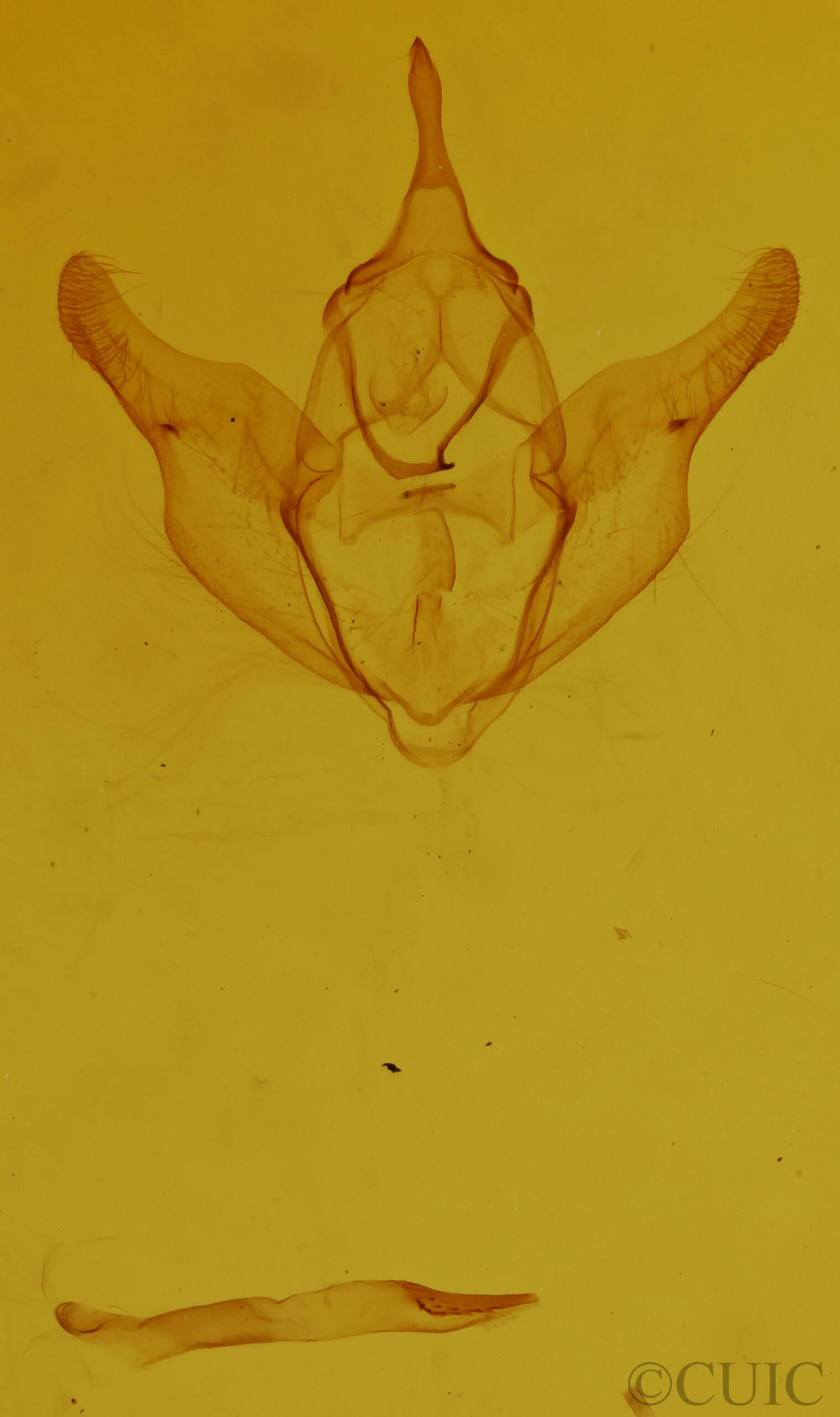 genitalia view of adult Stenaspilatodes  antidiscaria