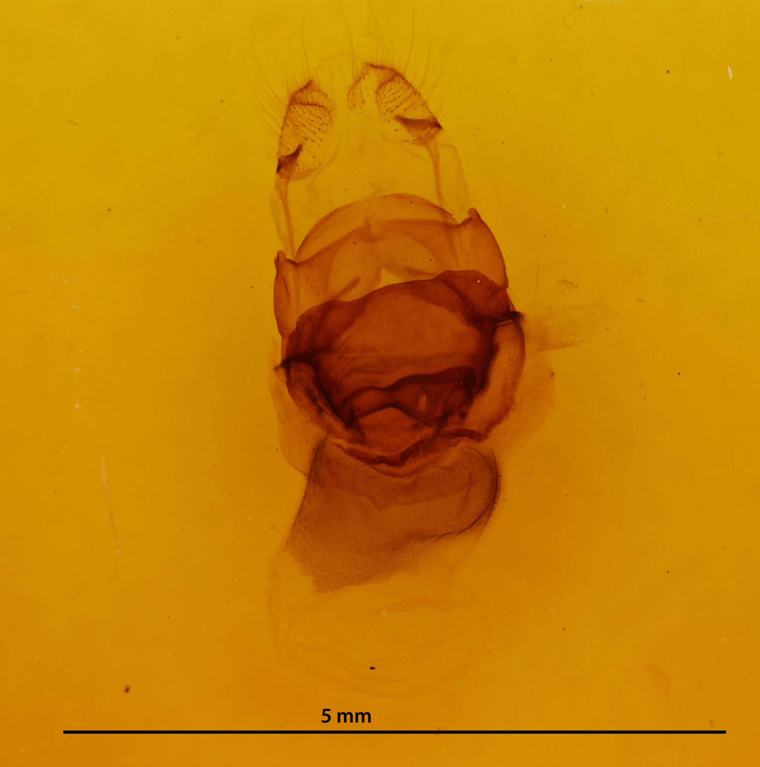 genitalia view of adult Symmerista suavis