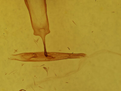 genitalia view of adult Targalla suffundens