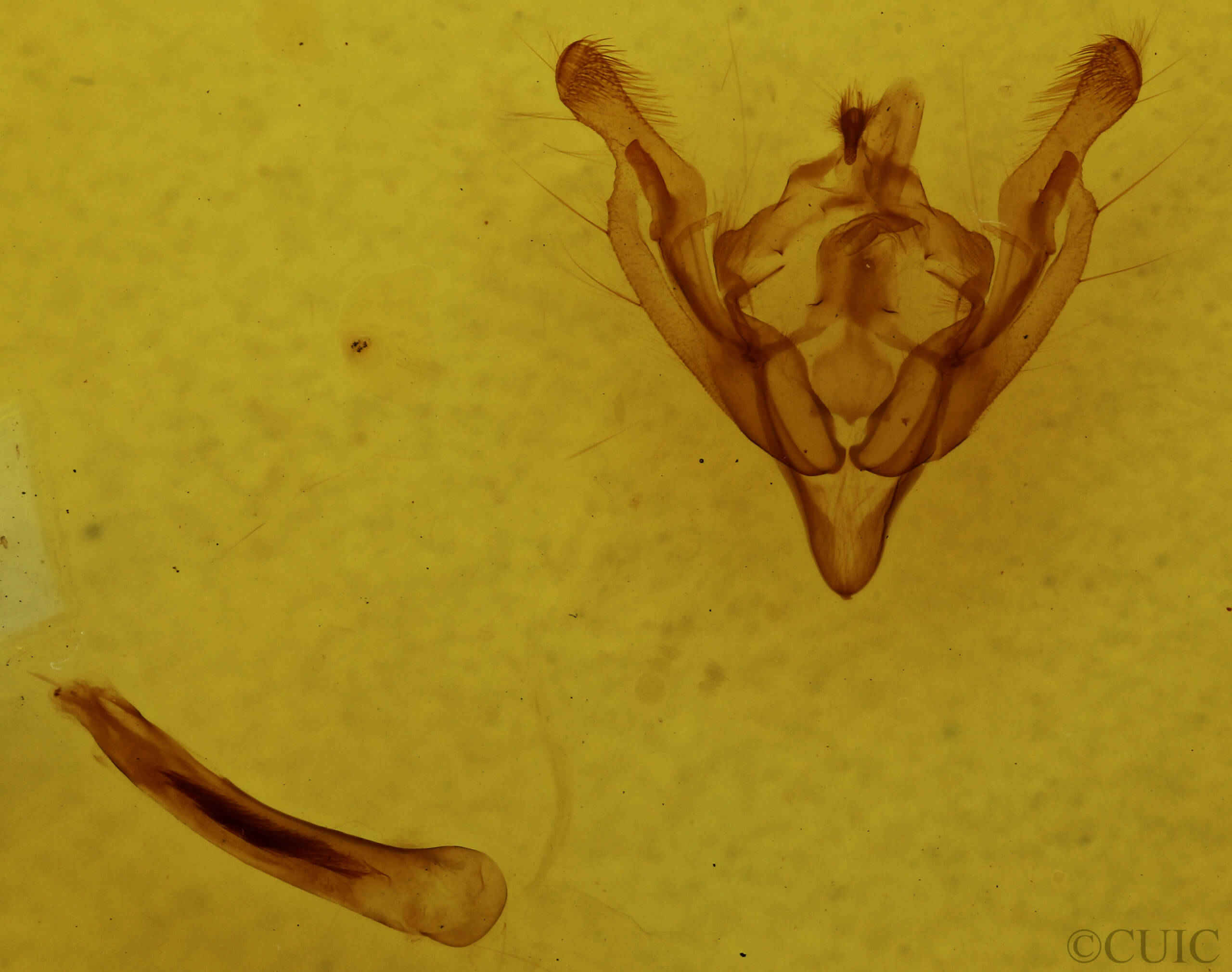 genitalia view of adult Ichneutica paraxysta