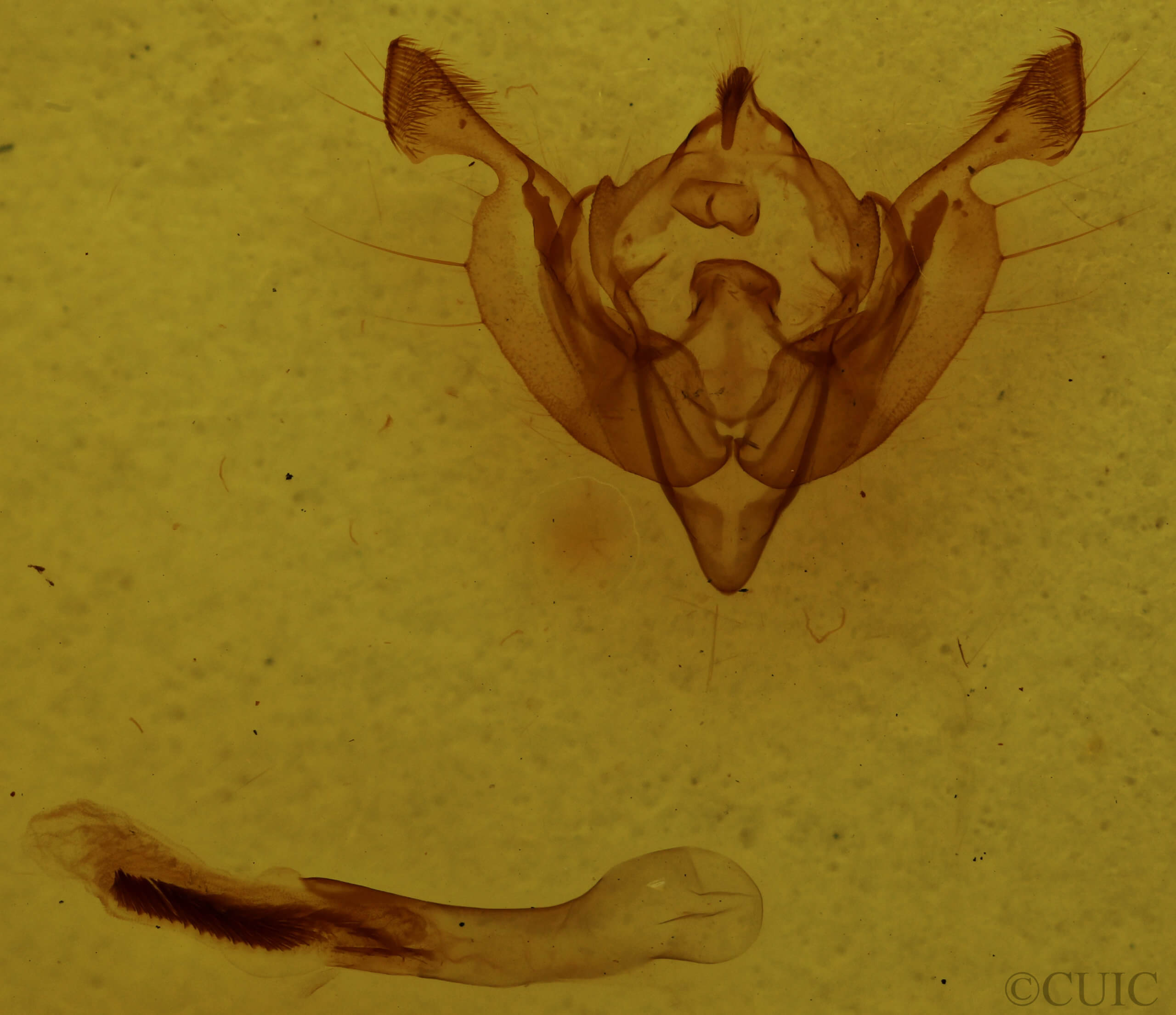 genitalia view of adult Ichneutica unica