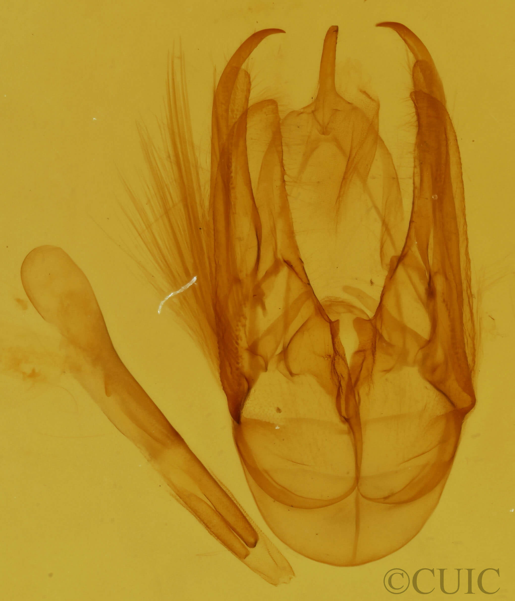 genitalia view of adult Xanthodes albago