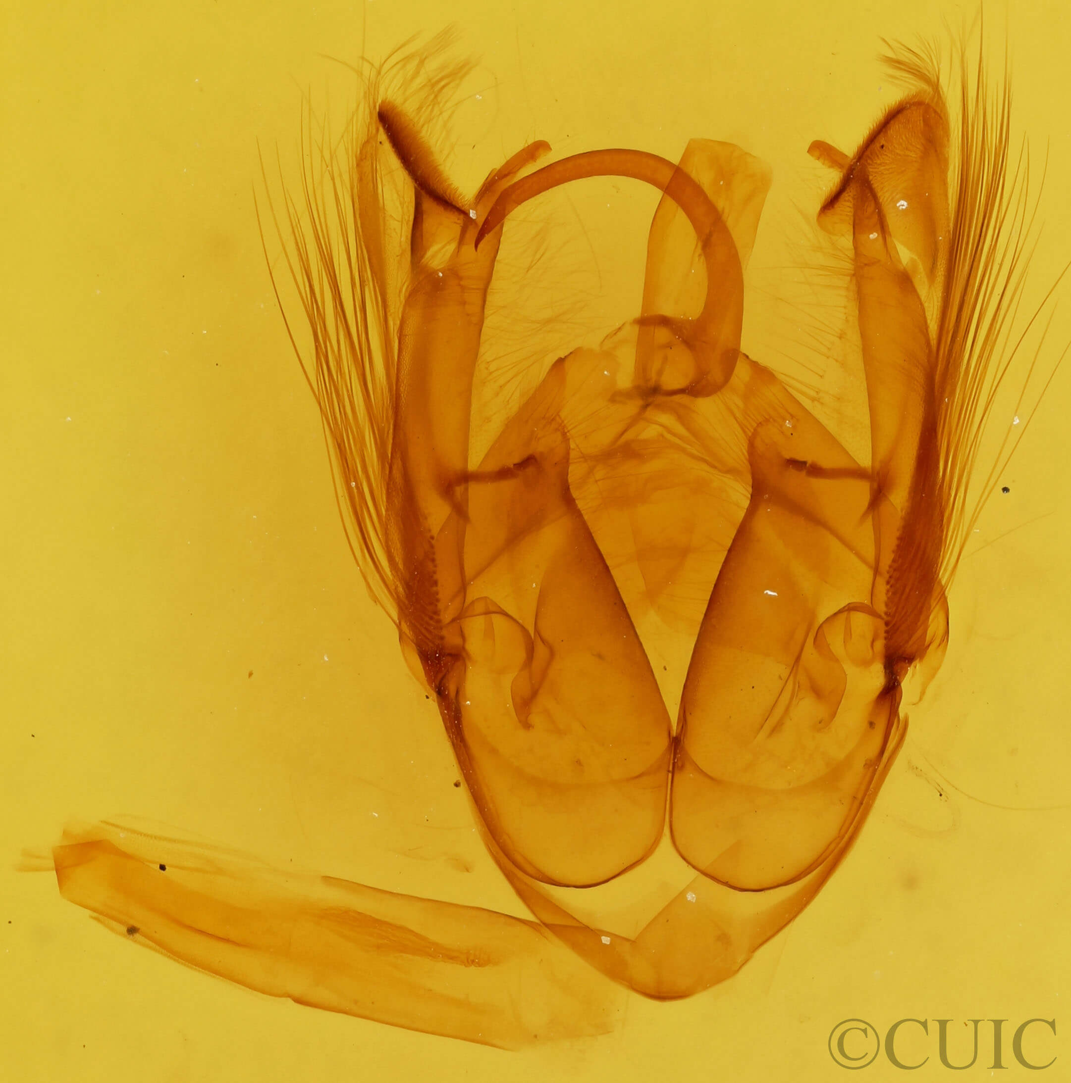 genitalia view of adult Xanthodes