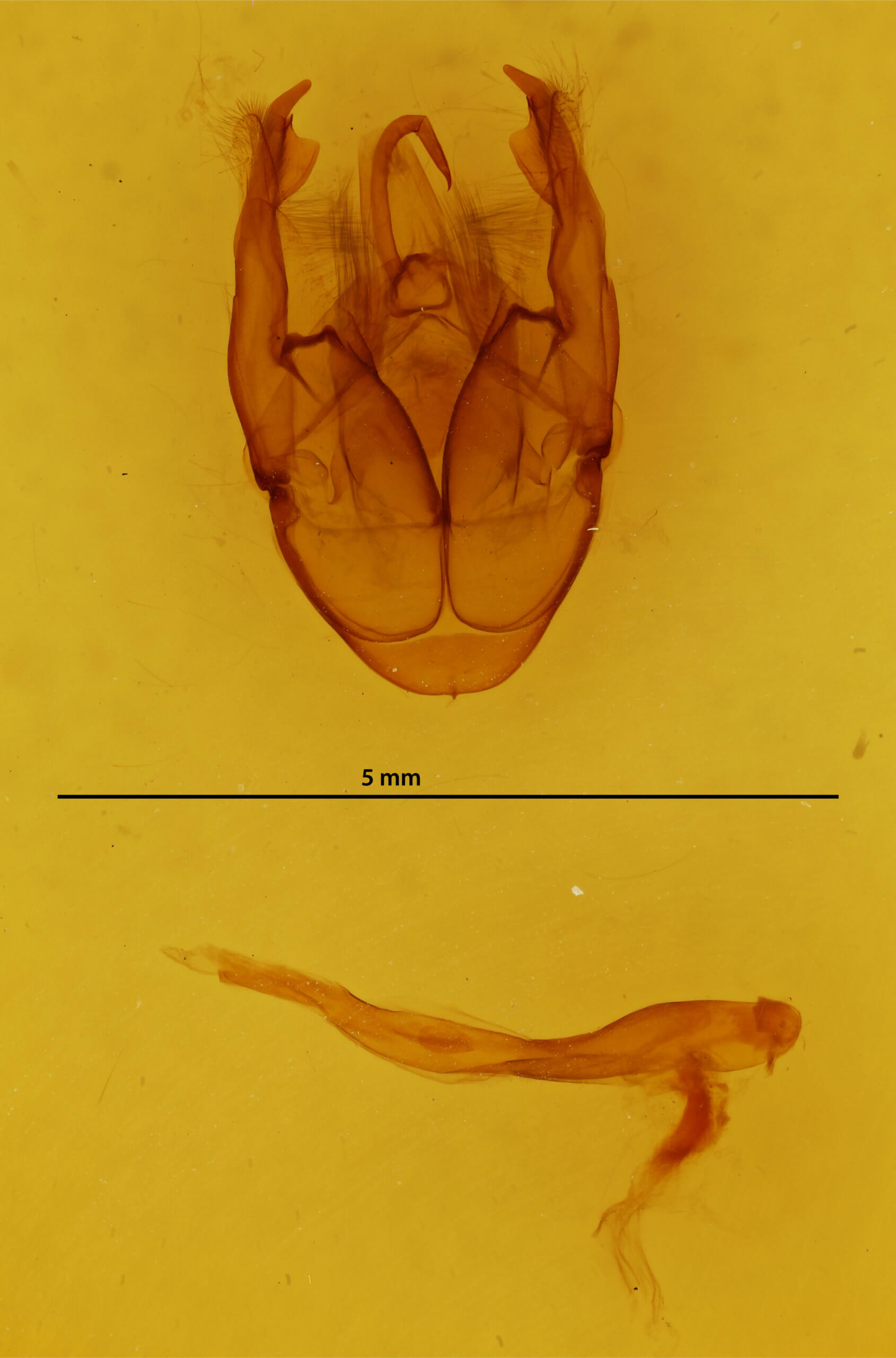 genitalia view of adult Xanthodes transversa