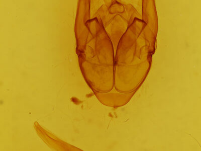 genitalia view of adult Xanthodes transversa