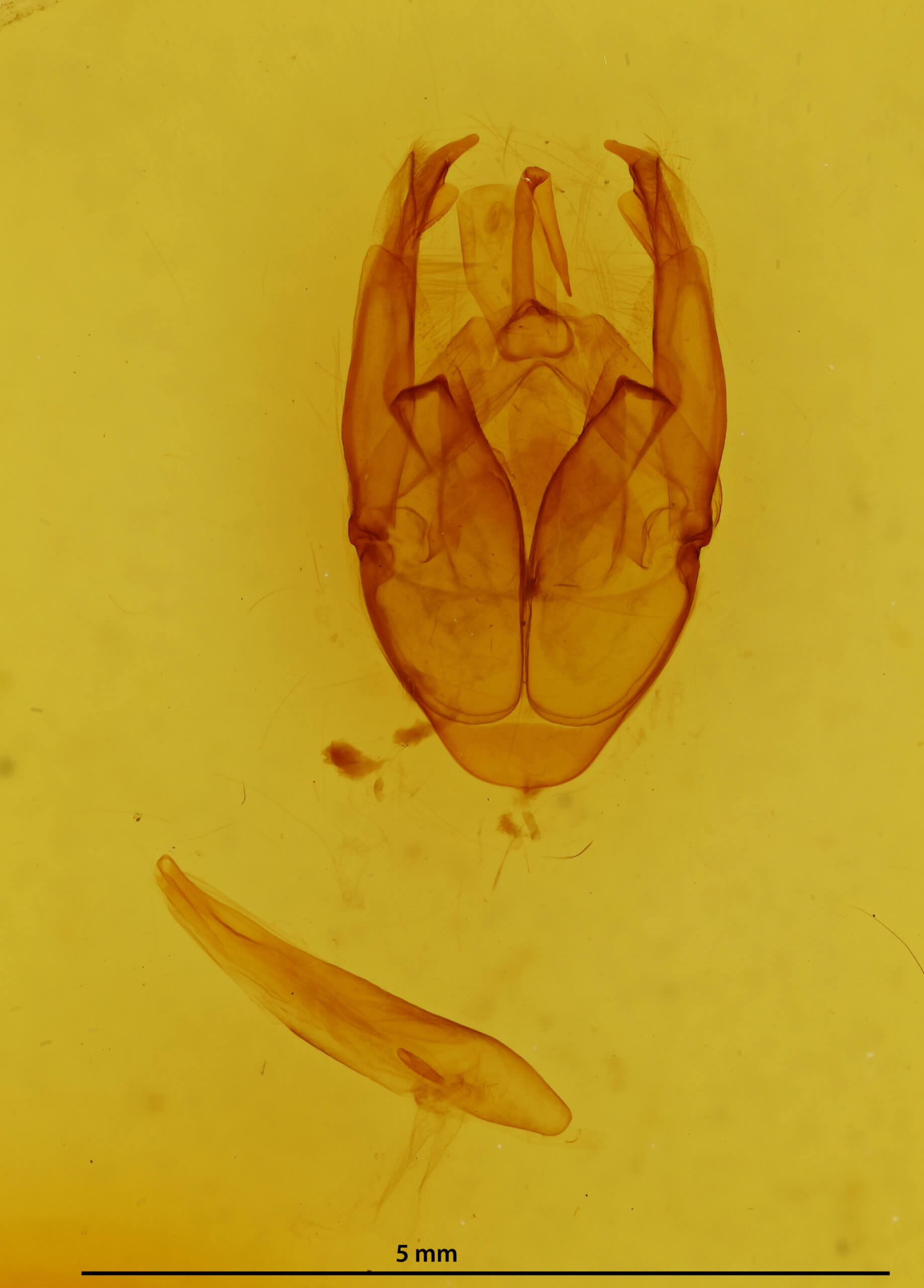 genitalia view of adult Xanthodes transversa