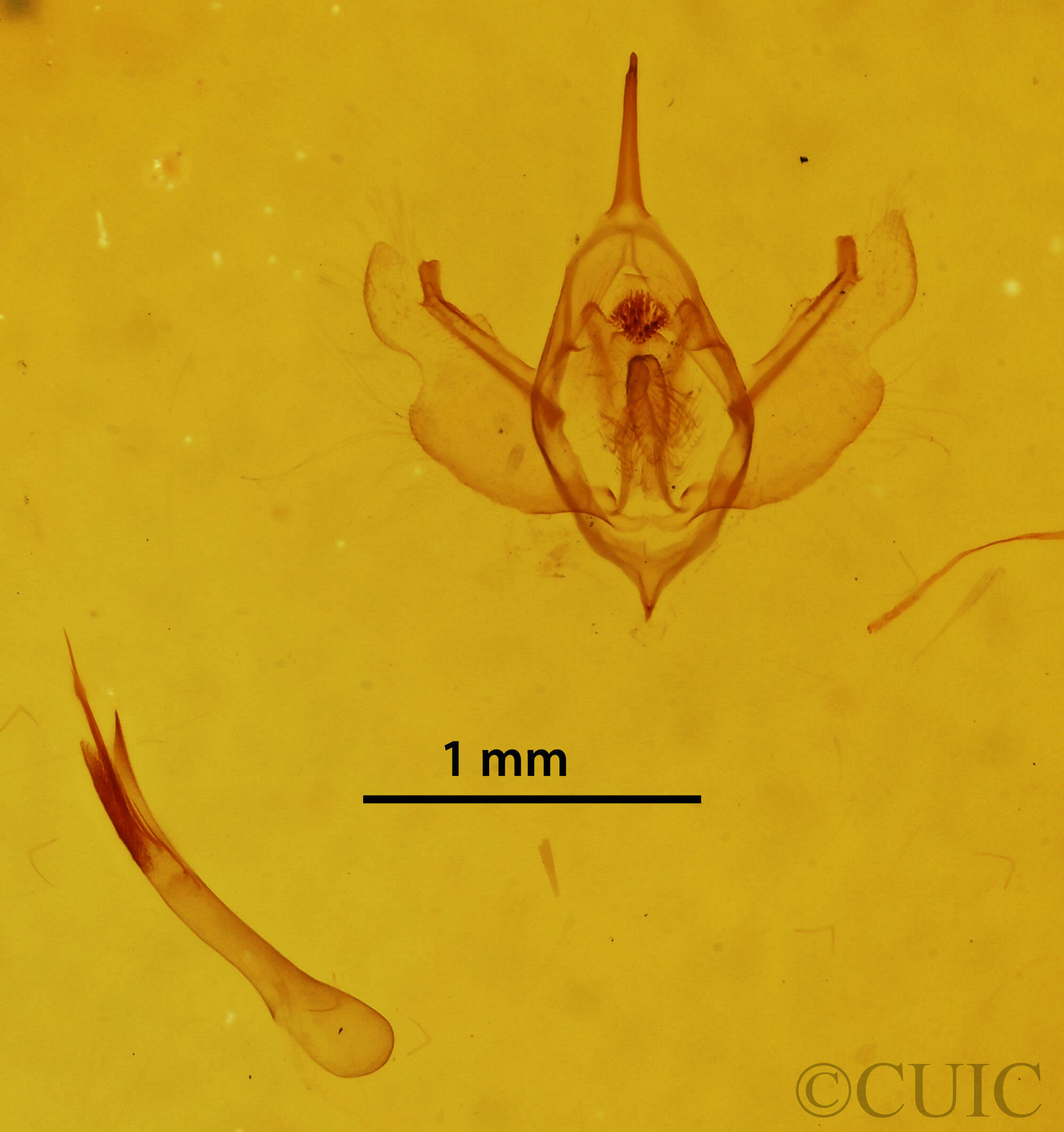 genitalia view of adult Xanthorhoe packardata